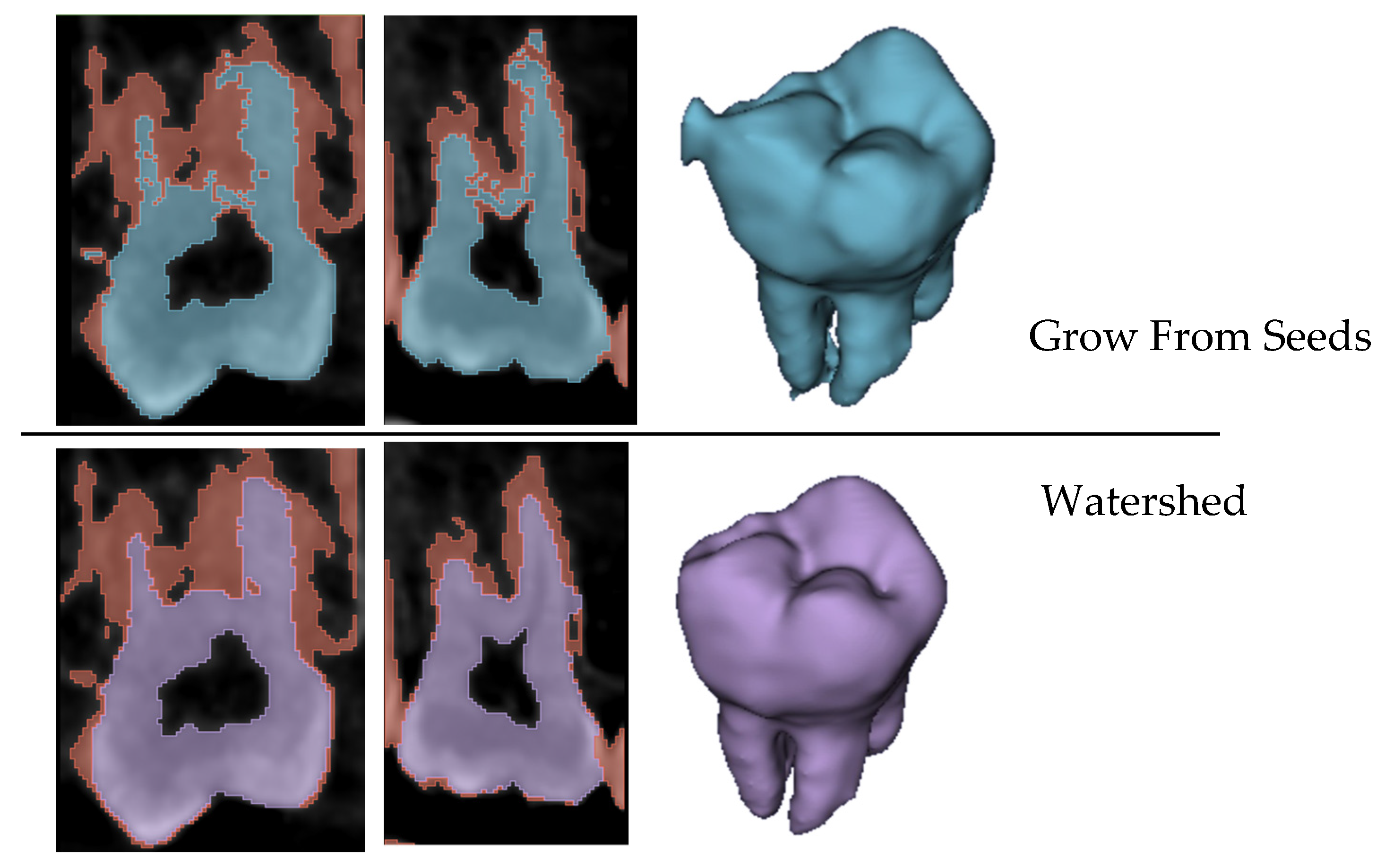 Jimaging 11 00340 g025 Jimaging 11 00340 g025