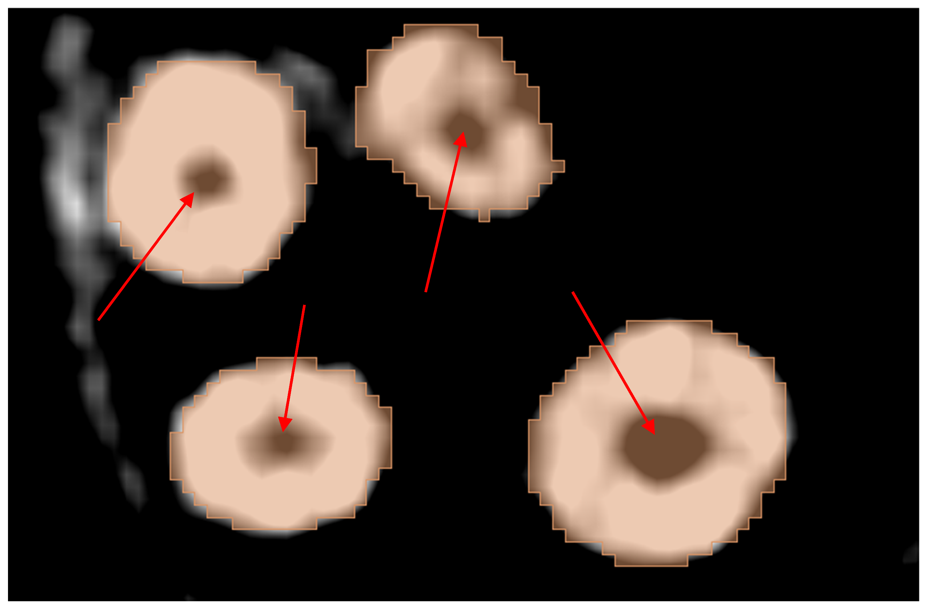 Jimaging 11 00340 g026 Jimaging 11 00340 g026