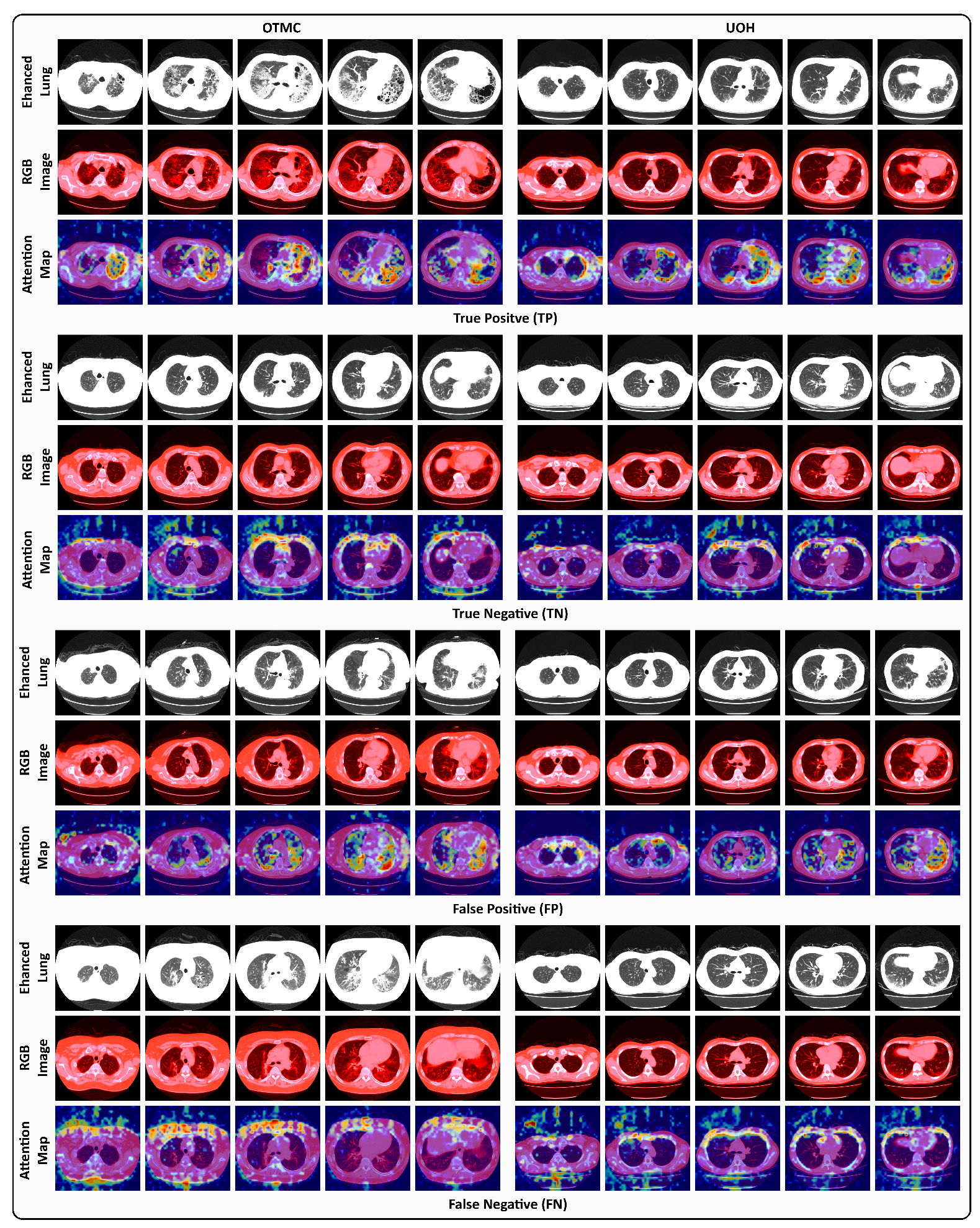 Jimaging 11 00353 g005