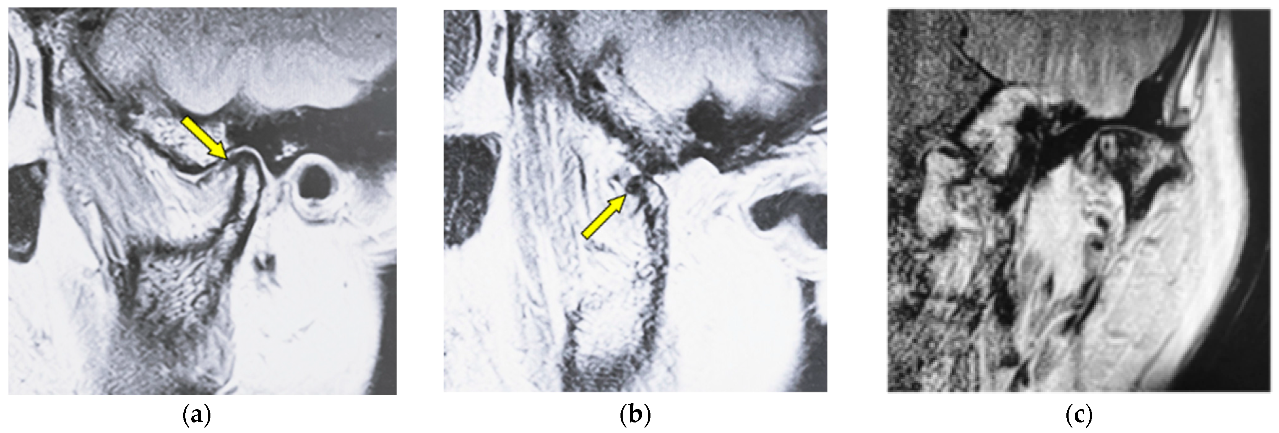 Jimaging 12 00005 g003