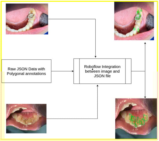 Dataset overview: polygonal JSON annotation of upper and lower jaw.