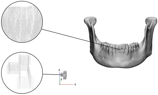 Mandible with its calibration object near the global origin and the corresponding regions as point clouds.