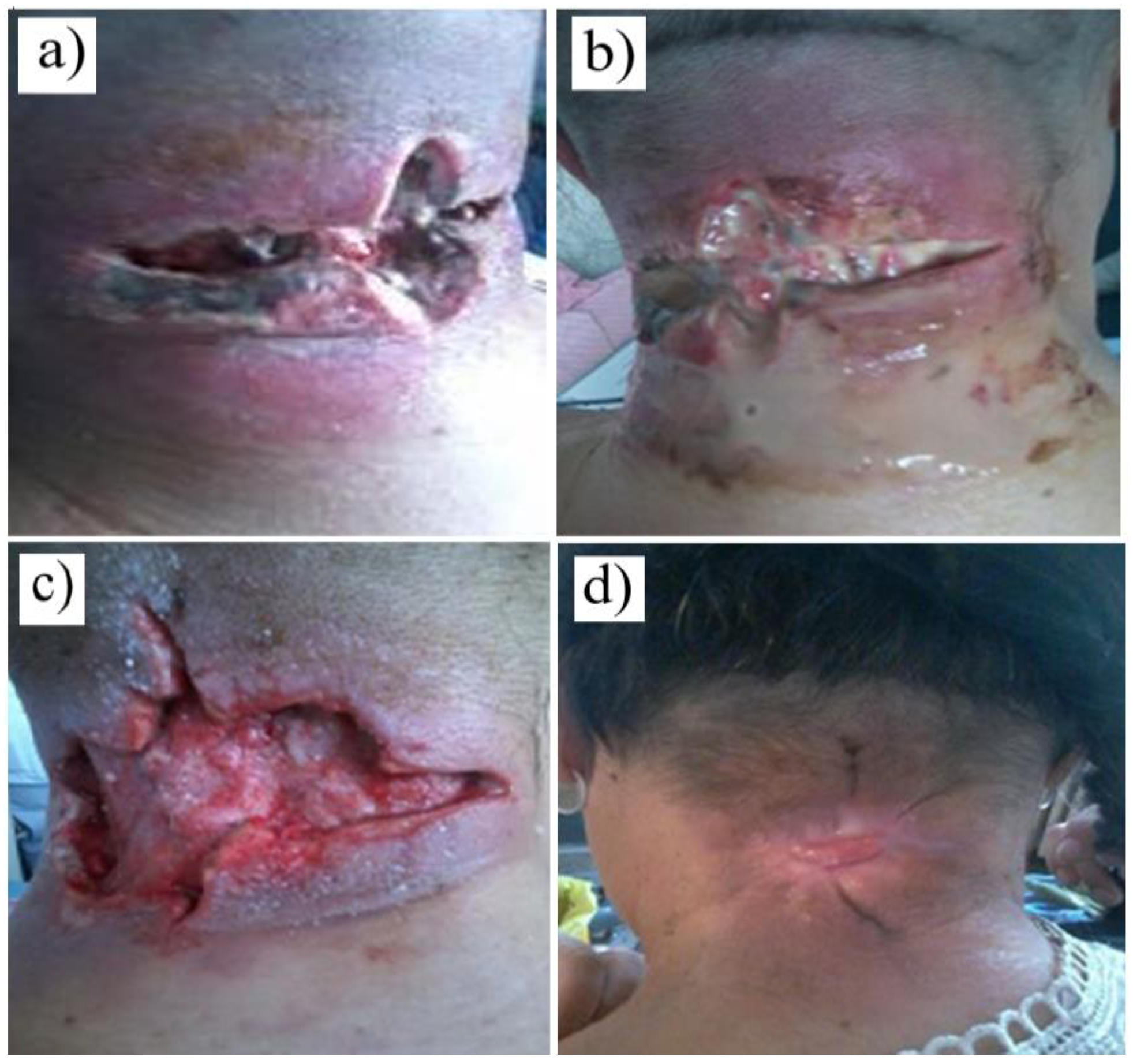 Jmms 10 00015 g001 Jmms 10 00015 g001