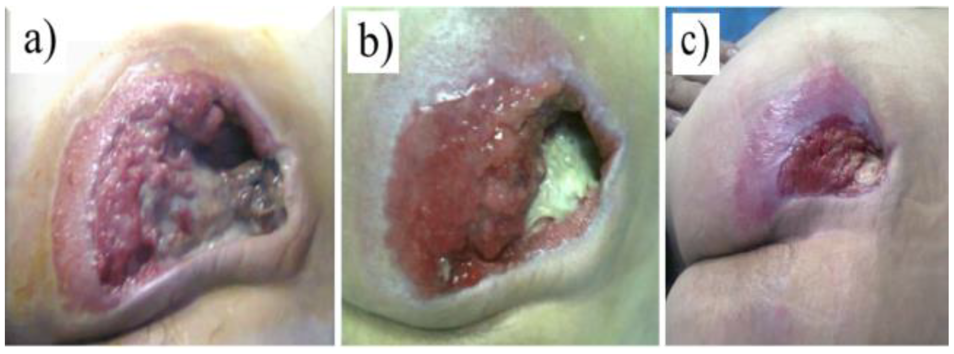 Jmms 10 00015 g002 Jmms 10 00015 g002