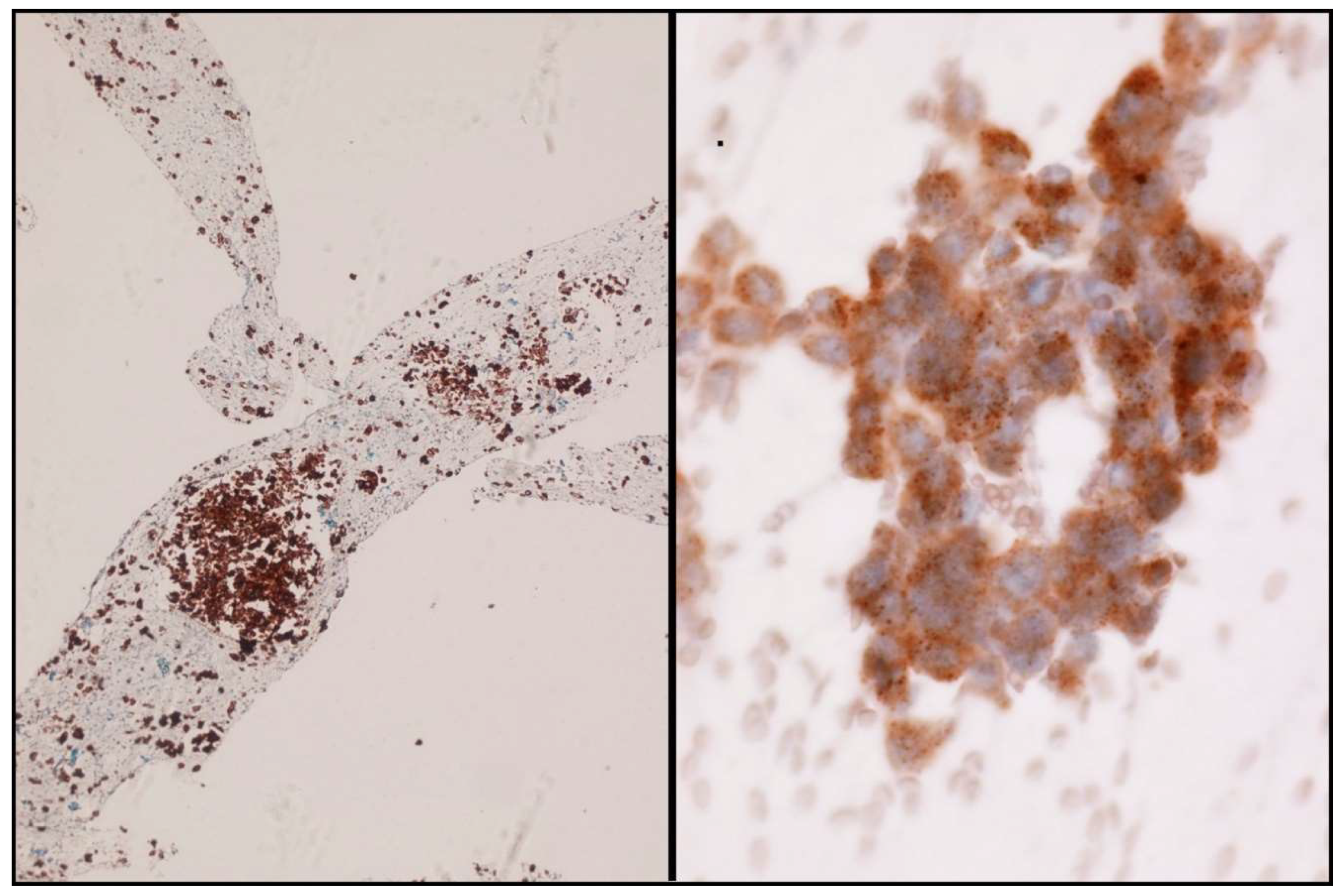 Jmp 02 00006 g004 Jmp 02 00006 g004