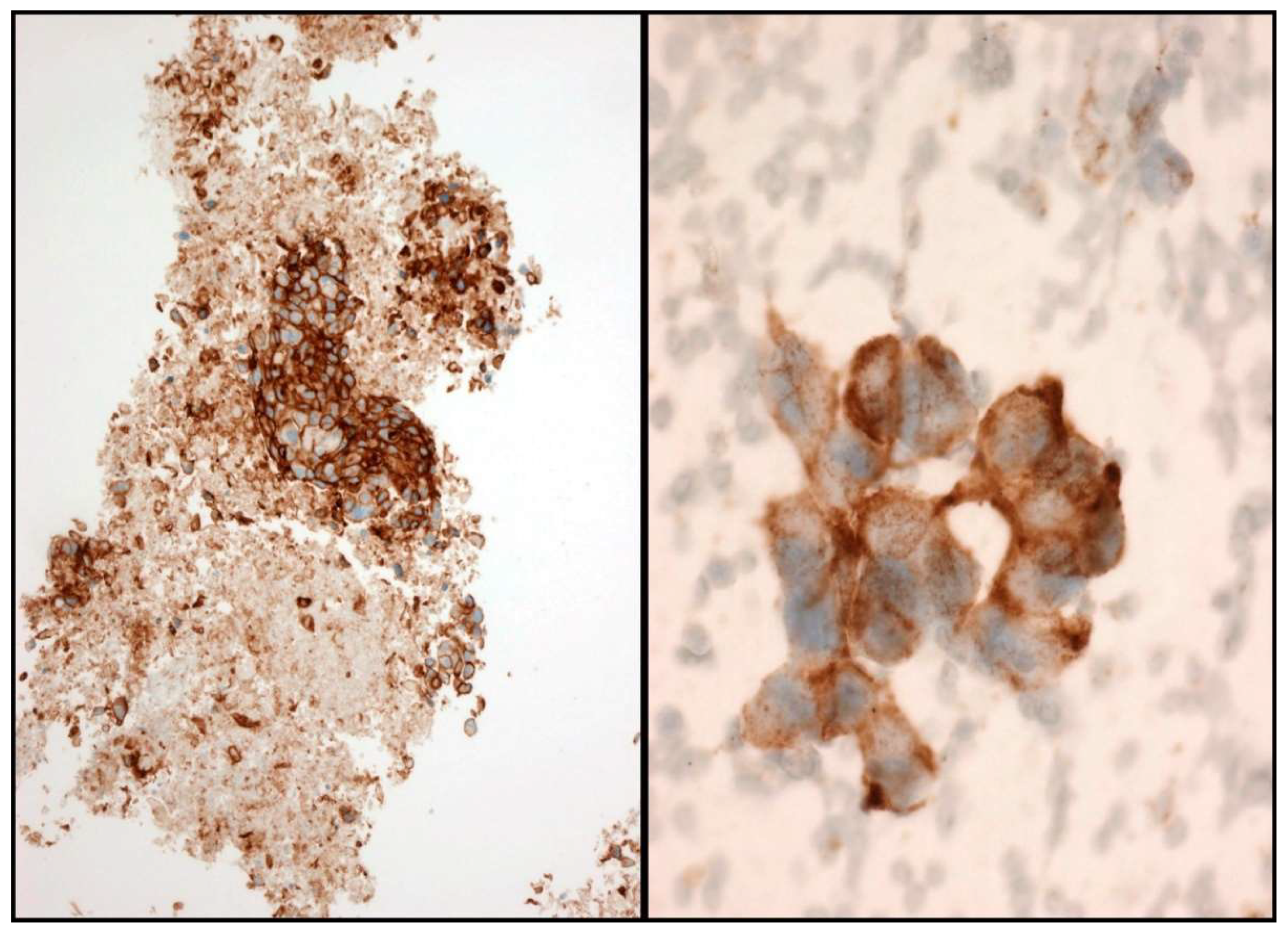 Jmp 02 00006 g005 Jmp 02 00006 g005