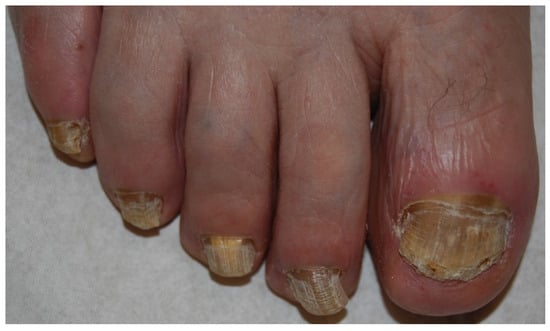 Jof 01 00030 g002 550