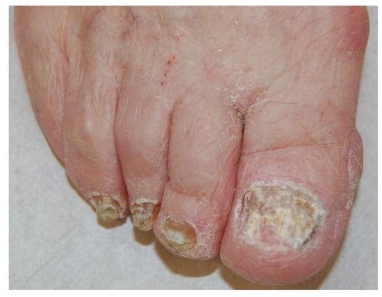 Jof 01 00030 g009 550