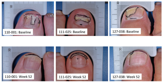 Jof 01 00107 g002 550