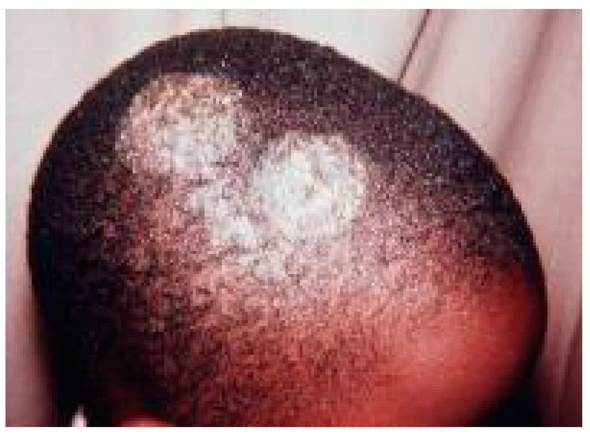 Jof 05 00038 g001 Jof 05 00038 g001