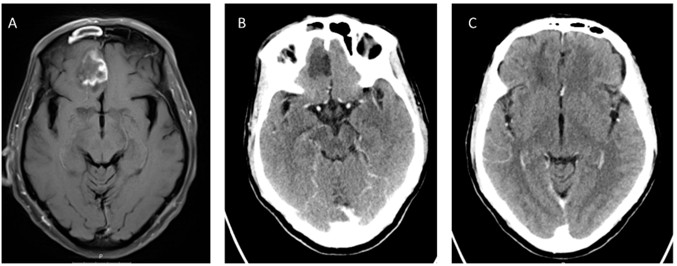 Jof 05 00059 g001 Jof 05 00059 g001