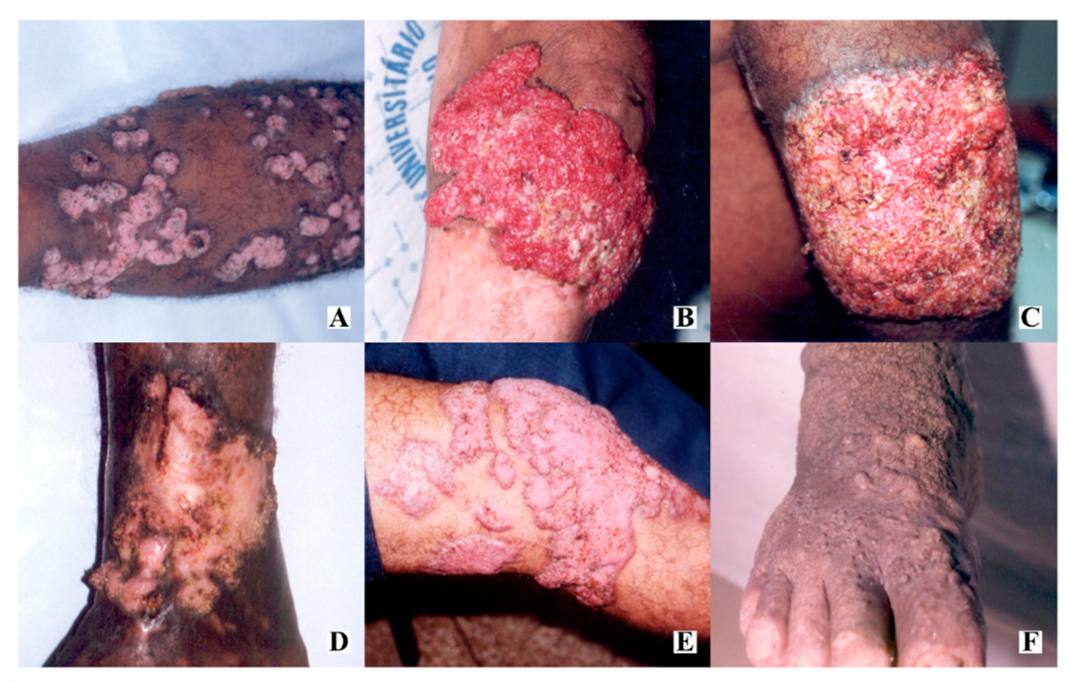 Jof 06 00204 g001 Jof 06 00204 g001