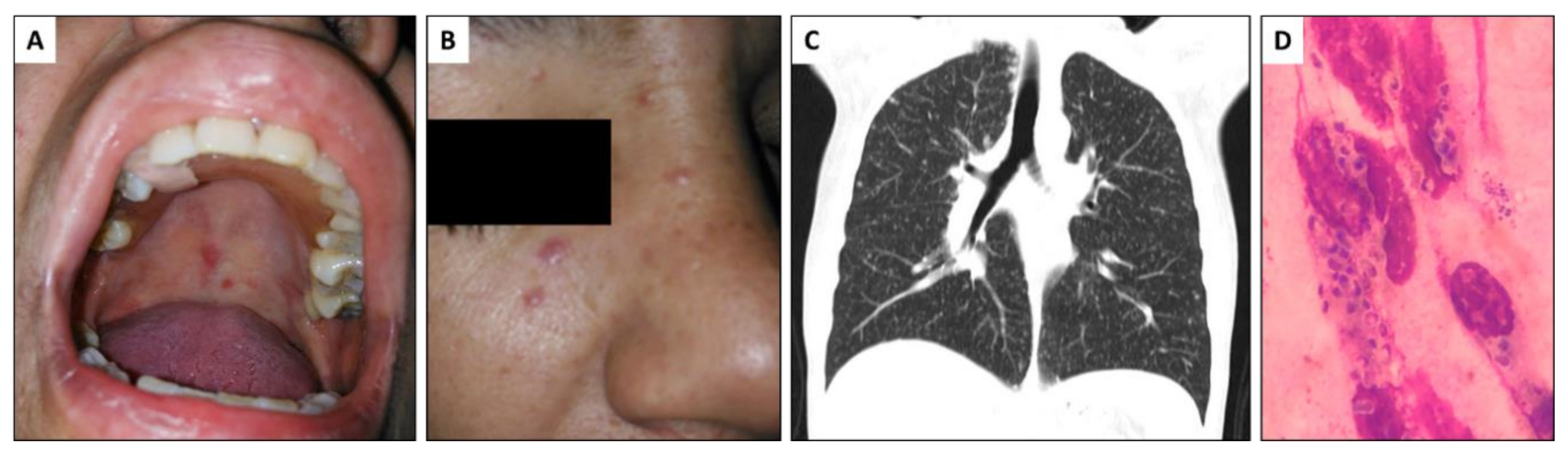 Jof 06 00275 g001 Jof 06 00275 g001