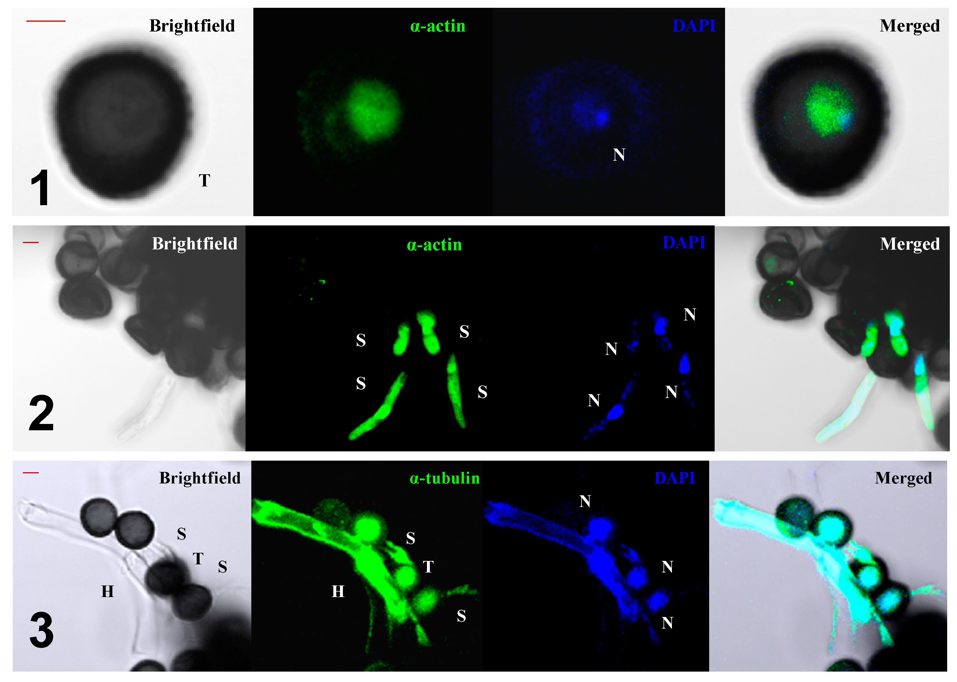 Jof 07 00044 g007 Jof 07 00044 g007