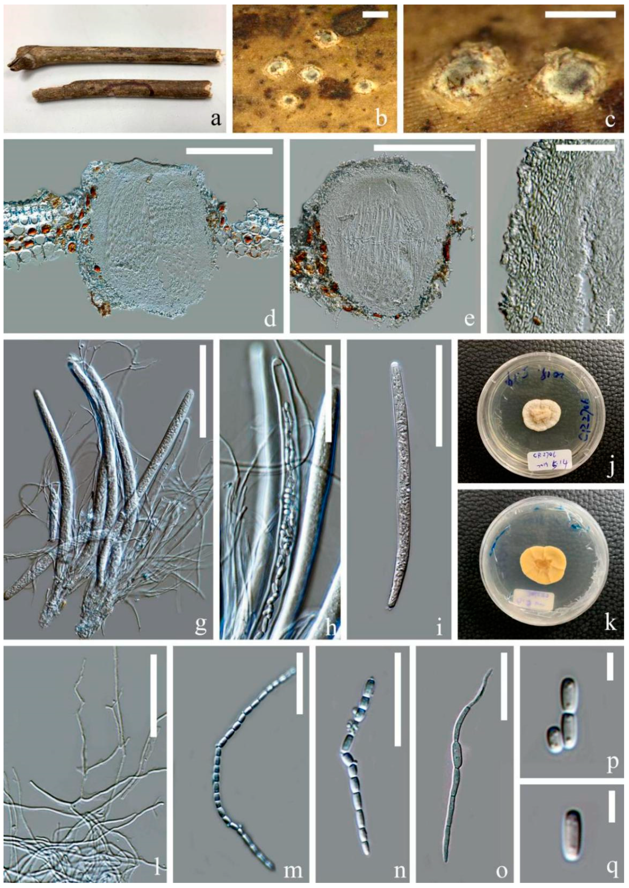 Jof 07 00880 g004 Jof 07 00880 g004