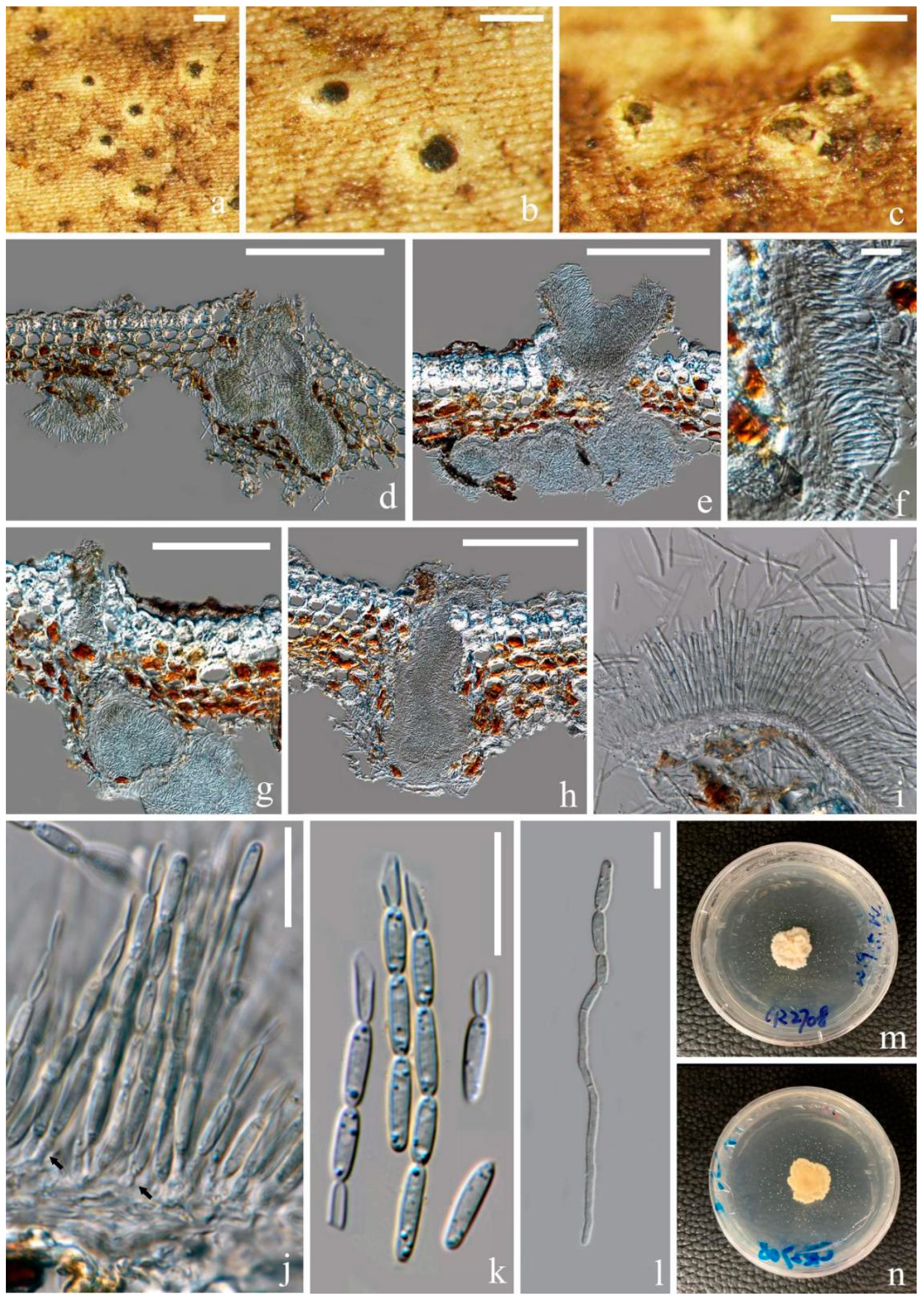 Jof 07 00880 g005 Jof 07 00880 g005