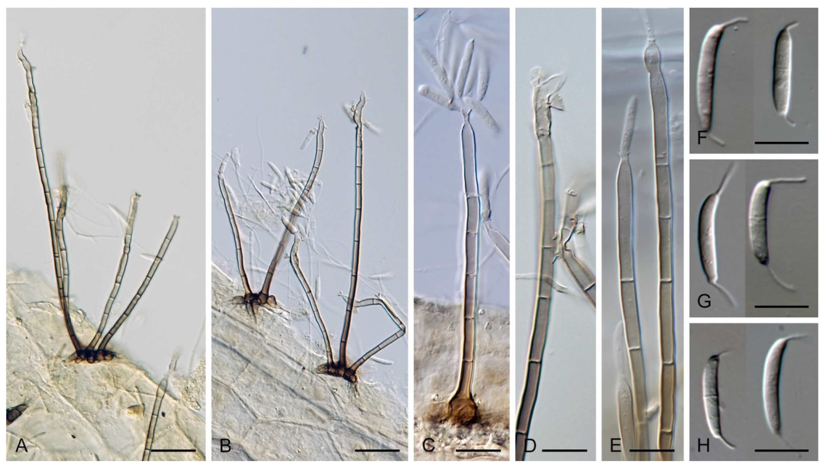 Jof 07 01097 g033 Jof 07 01097 g033