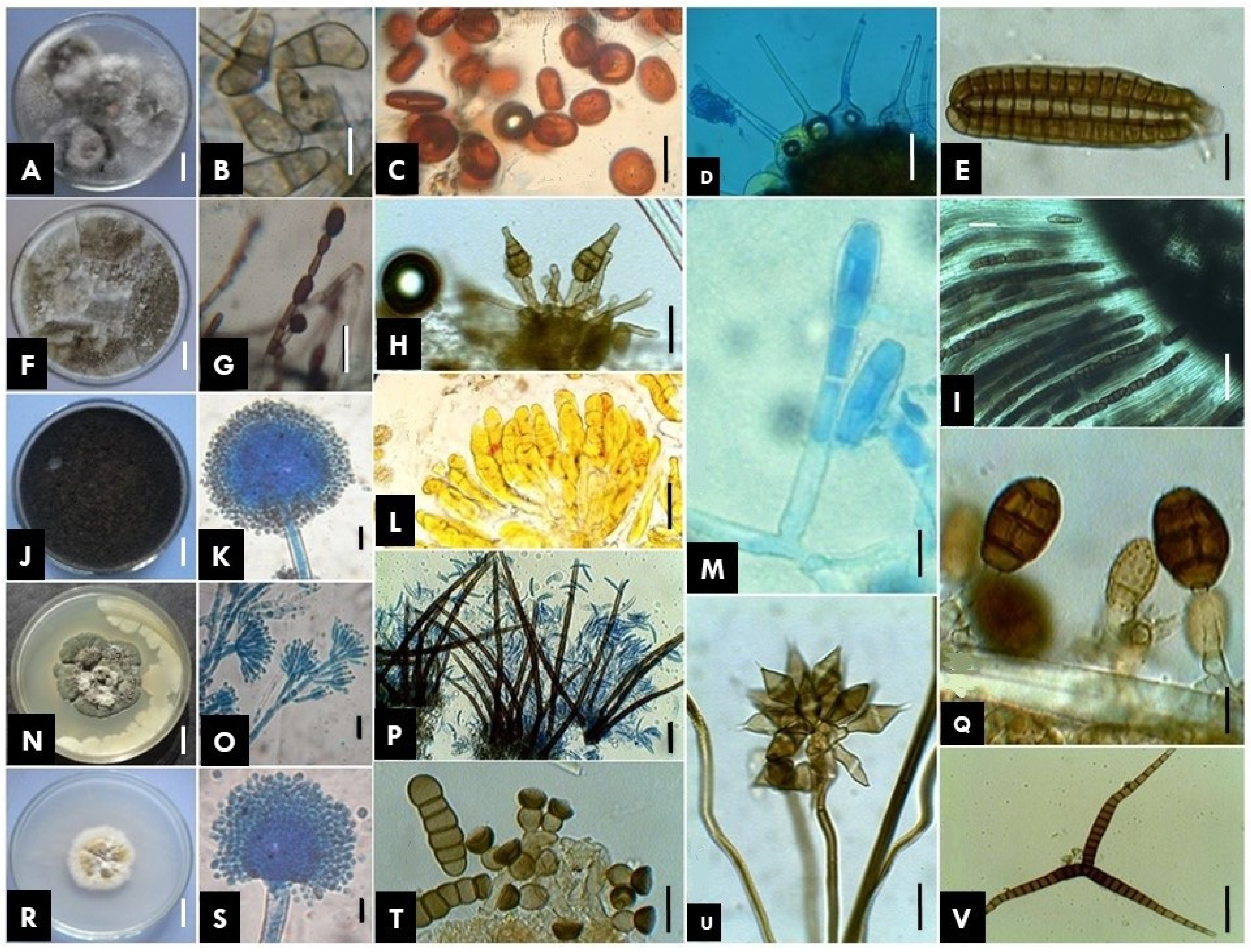 Jof 08 00226 g002 Jof 08 00226 g002