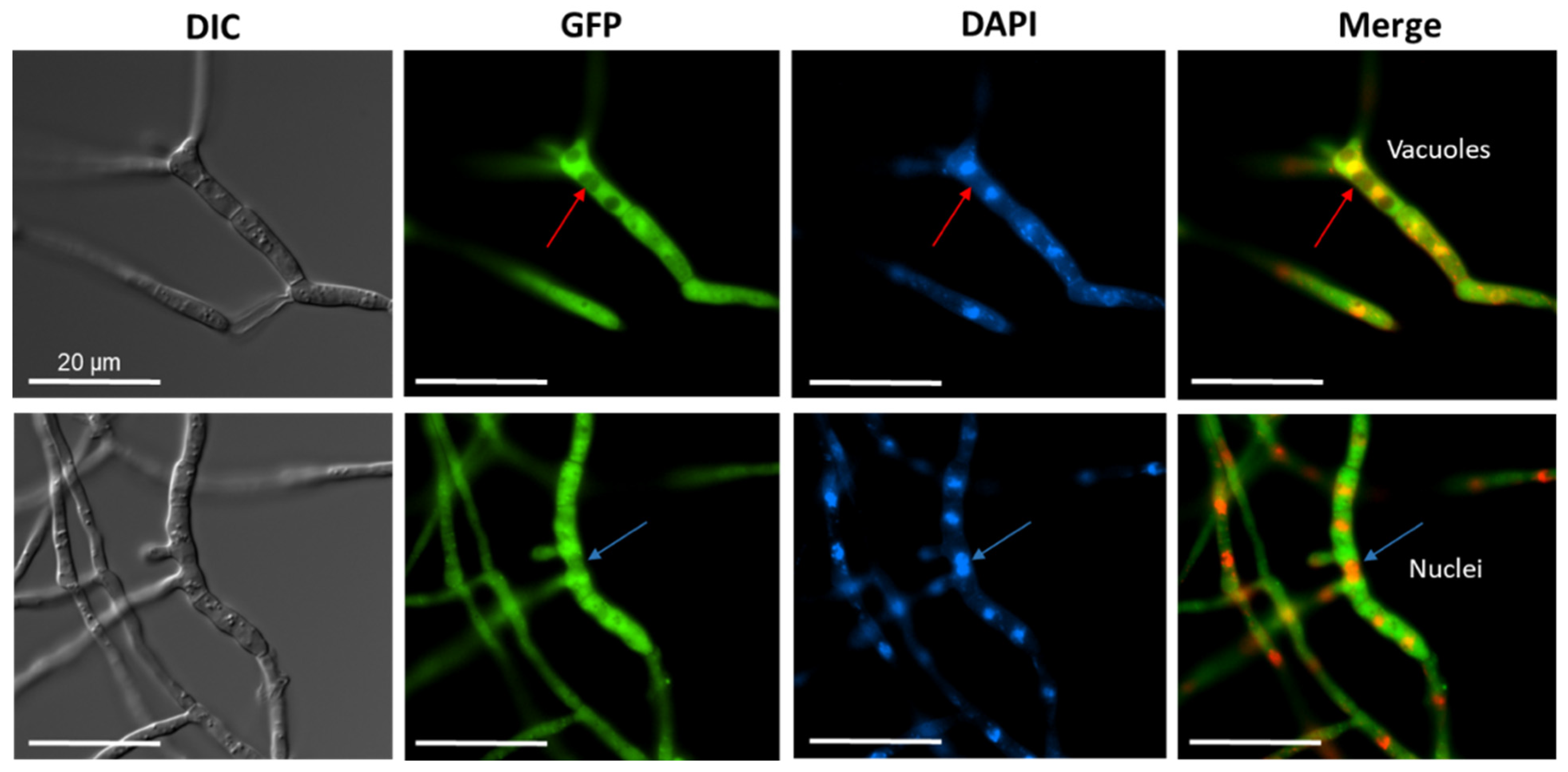 Jof 08 00450 g004 Jof 08 00450 g004