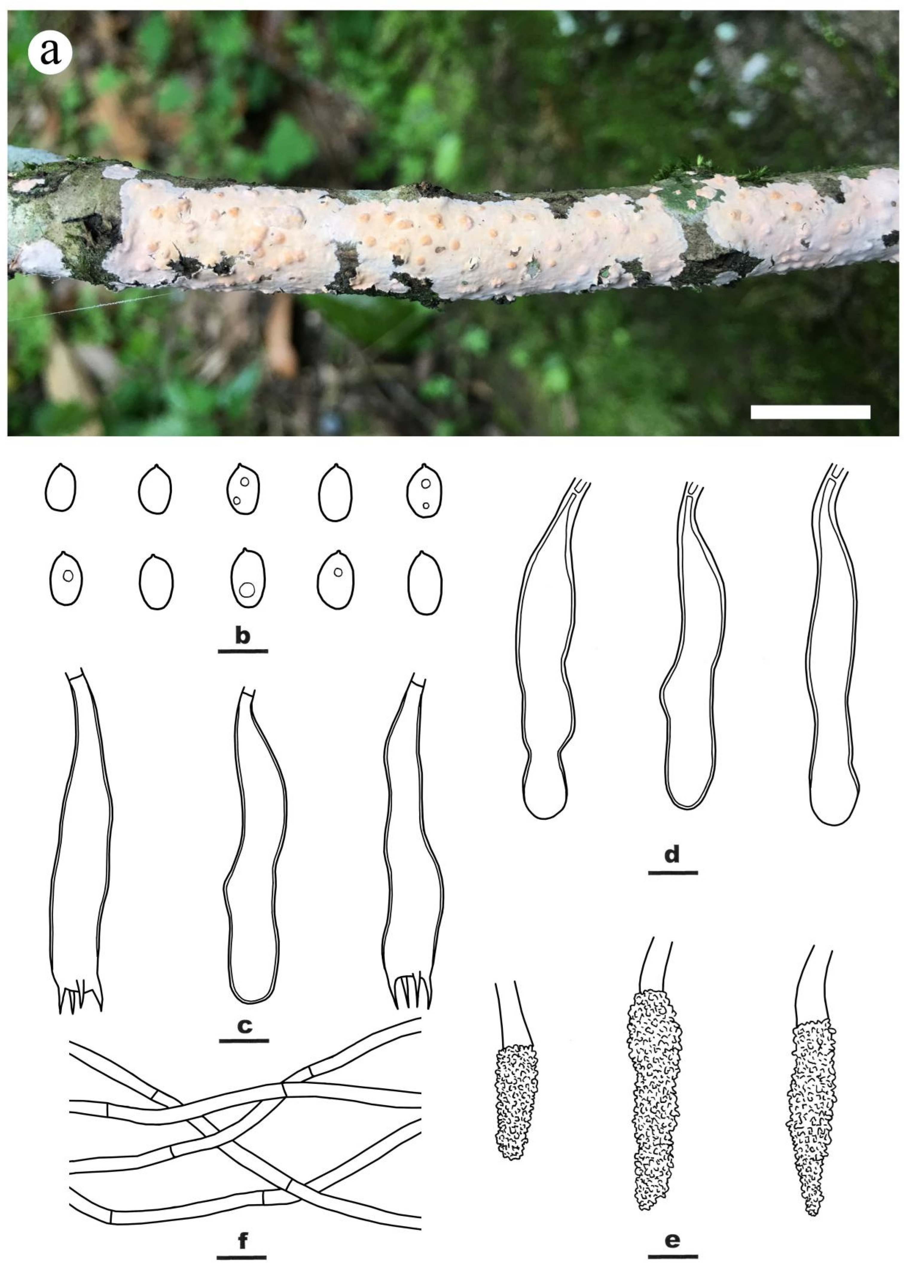 Jof 09 00093 g003 Jof 09 00093 g003