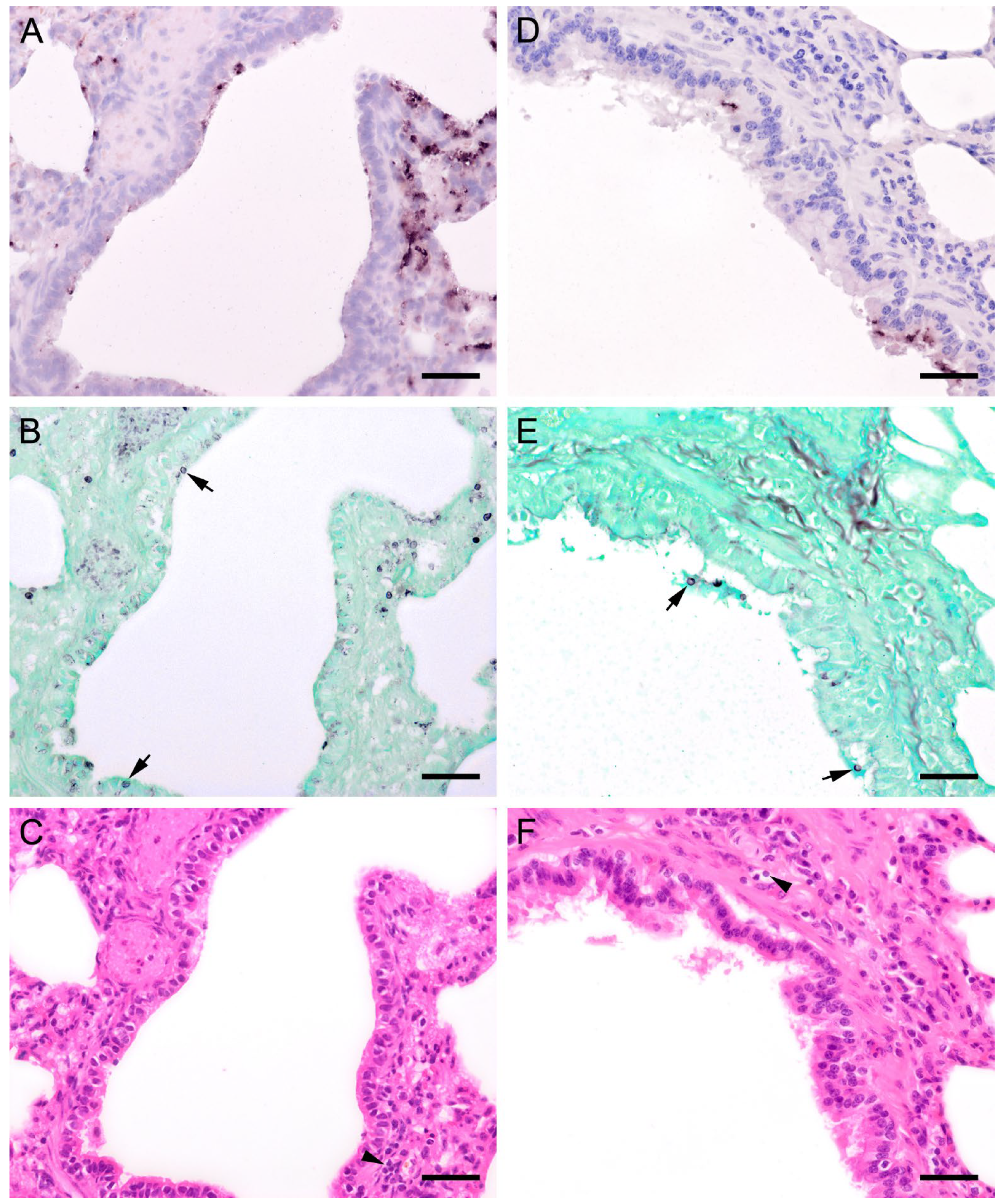 Jof 09 00220 g009 Jof 09 00220 g009