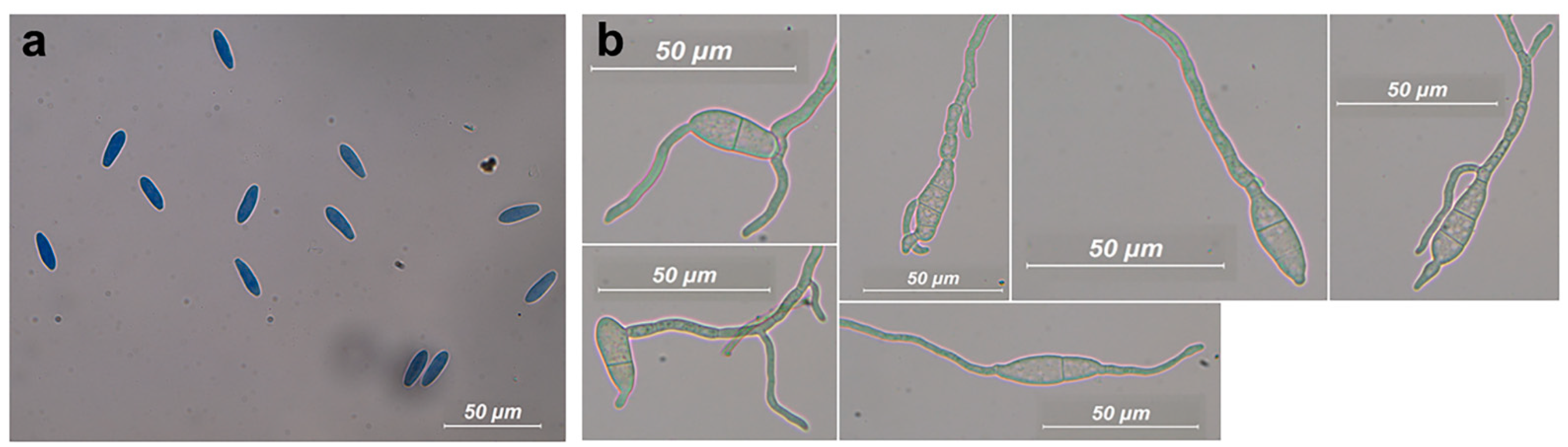Jof 09 00292 g003 Jof 09 00292 g003