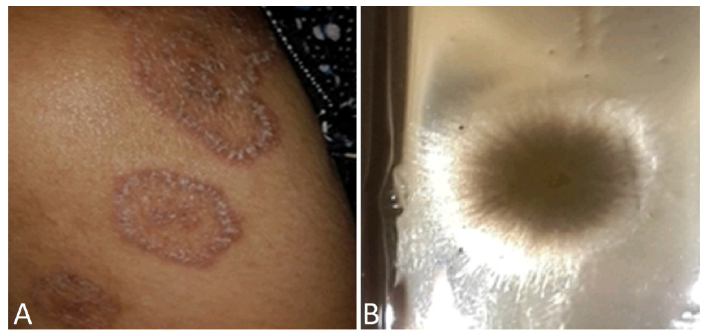 Jof 10 00295 g003 Jof 10 00295 g003