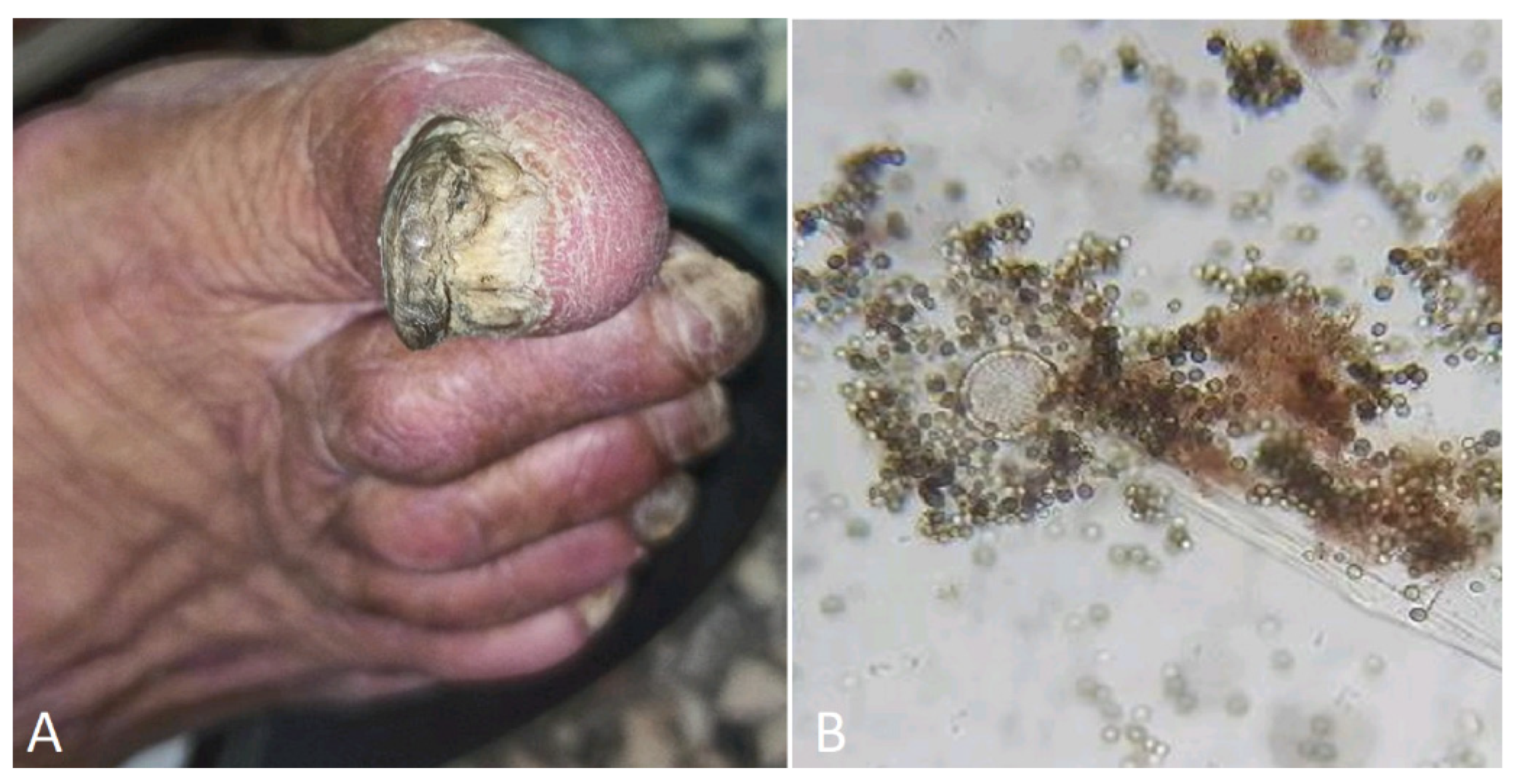 Jof 10 00295 g006 Jof 10 00295 g006