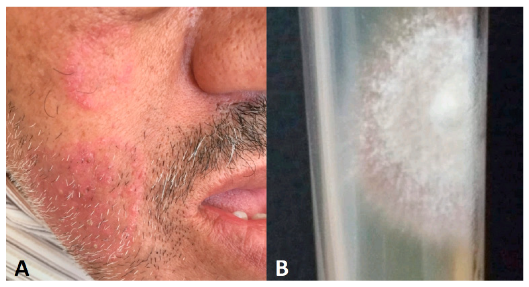 Jof 10 00295 g007 Jof 10 00295 g007