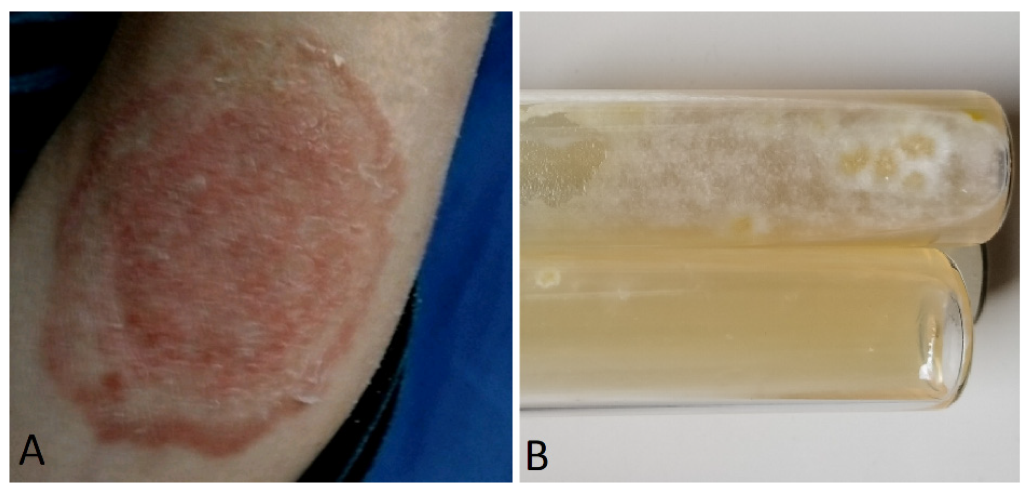 Jof 10 00295 g010 Jof 10 00295 g010