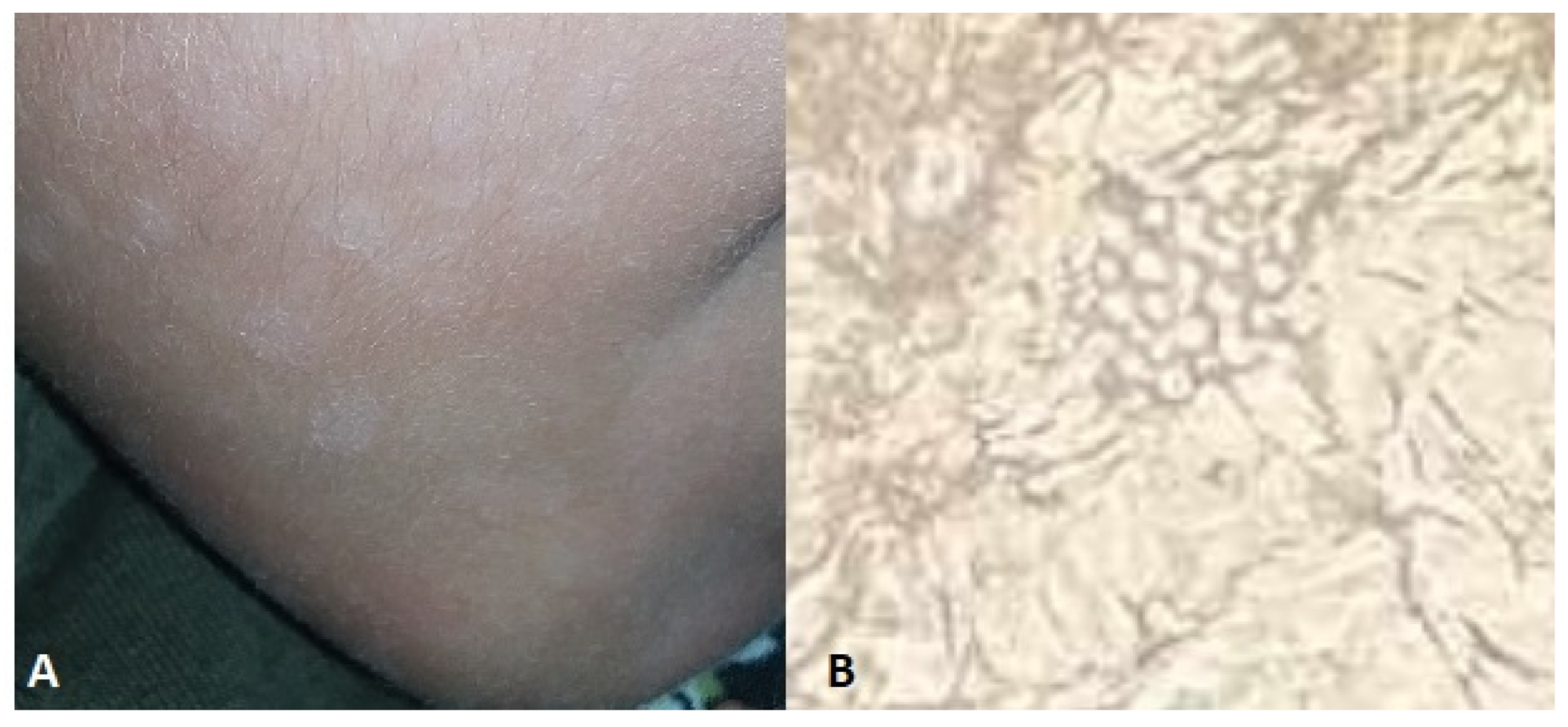 Jof 10 00295 g011 Jof 10 00295 g011