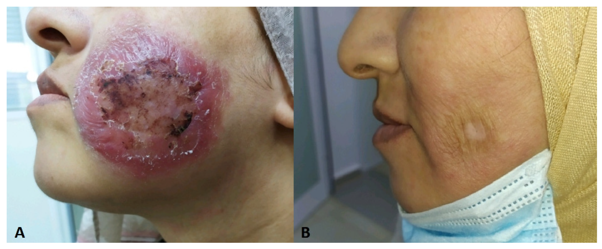 Jof 10 00295 g012 Jof 10 00295 g012