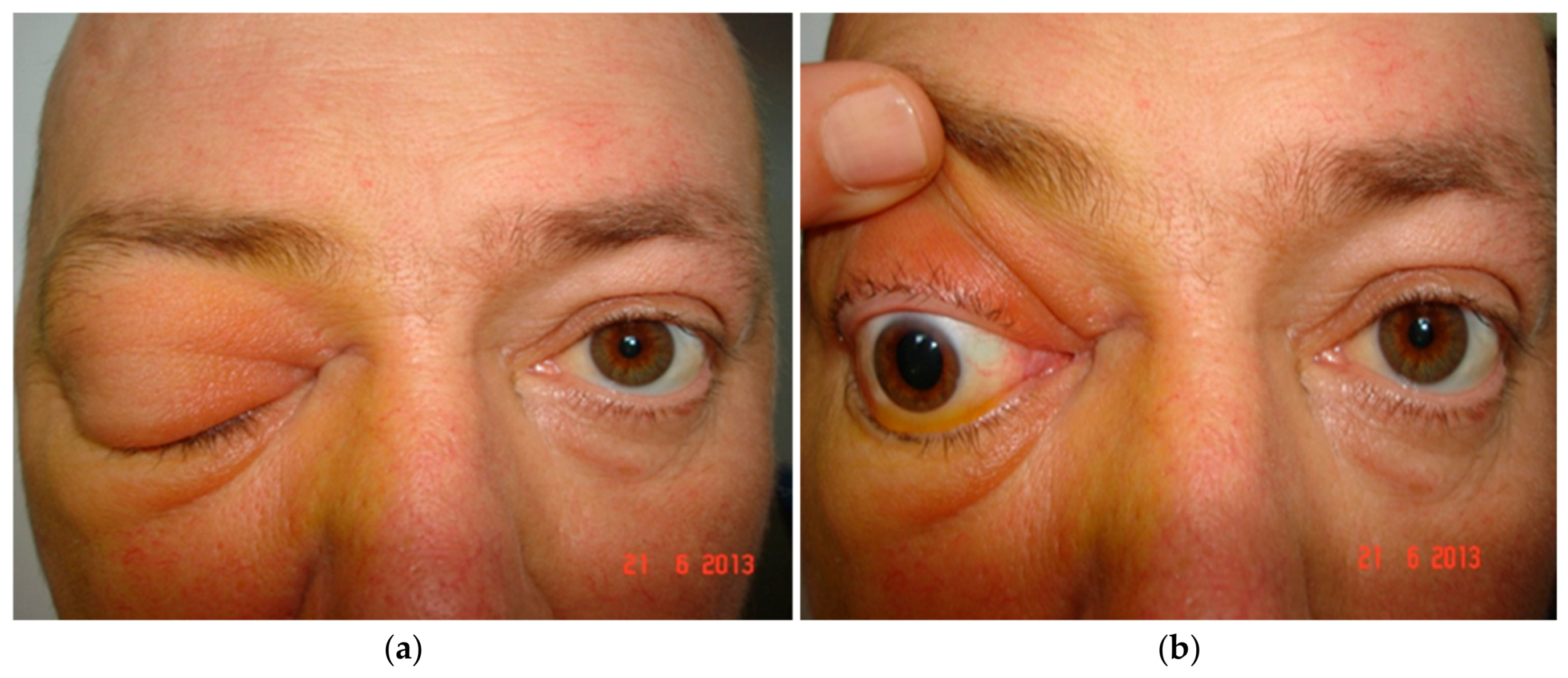Jof 12 00744 g010 Jof 12 00744 g010
