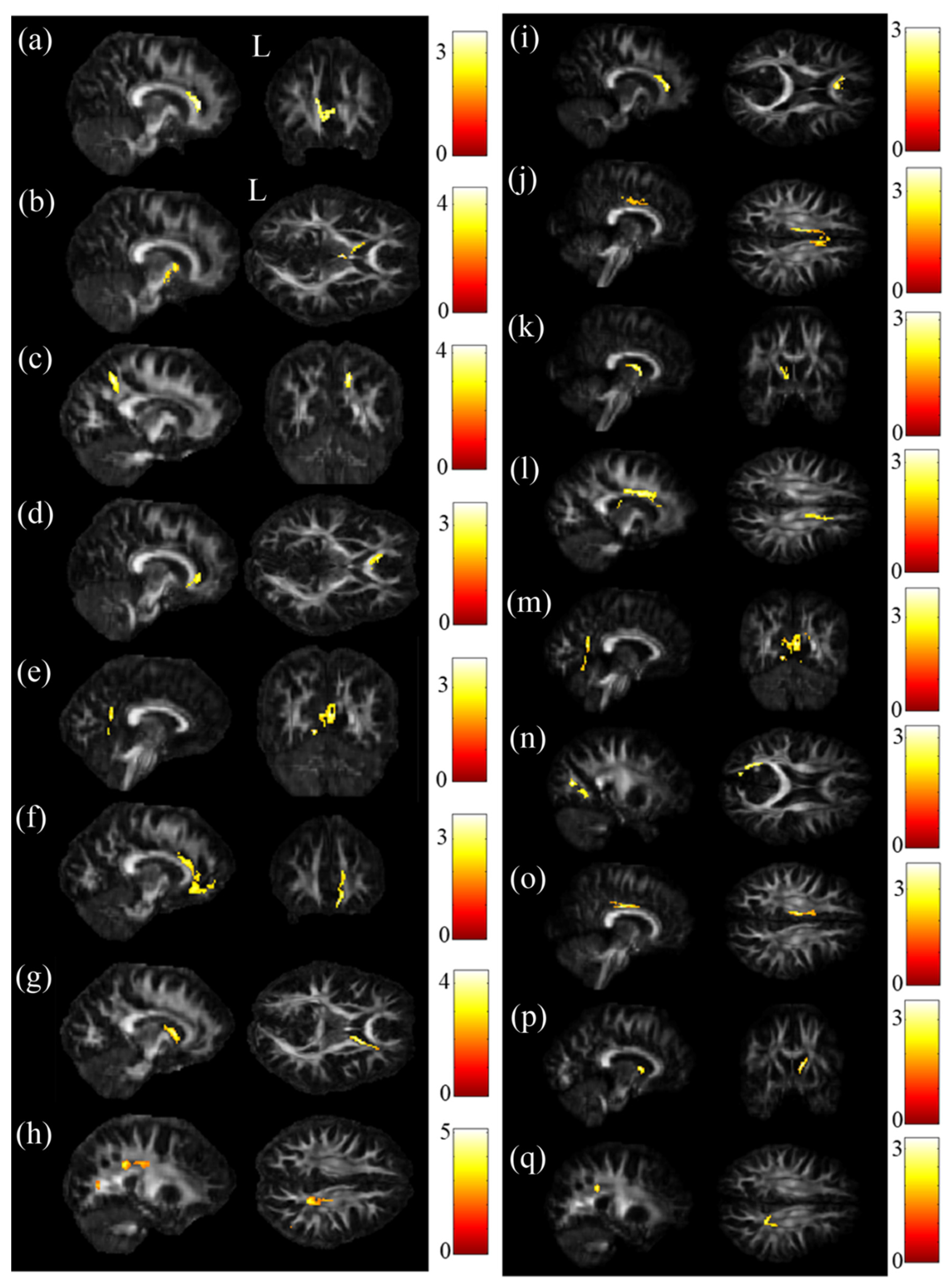 Jpm 11 00174 g002 Jpm 11 00174 g002
