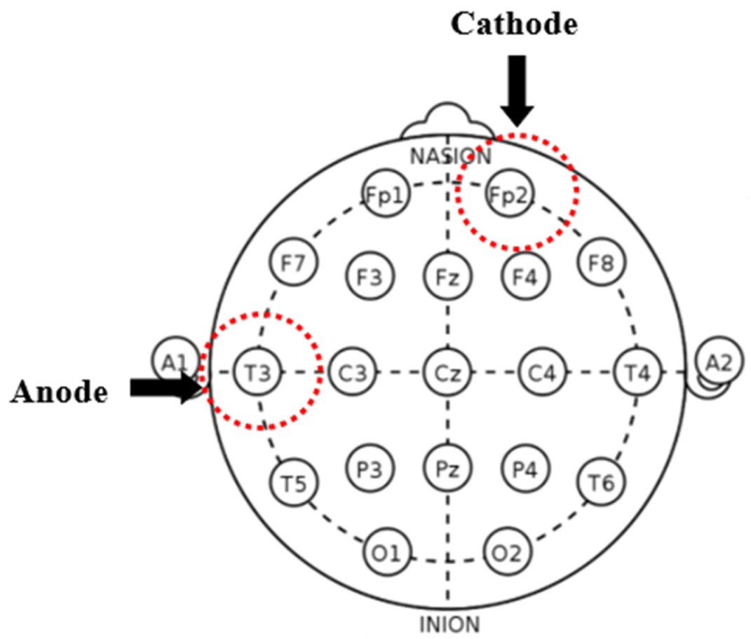 Jpm 11 00317 g002 Jpm 11 00317 g002