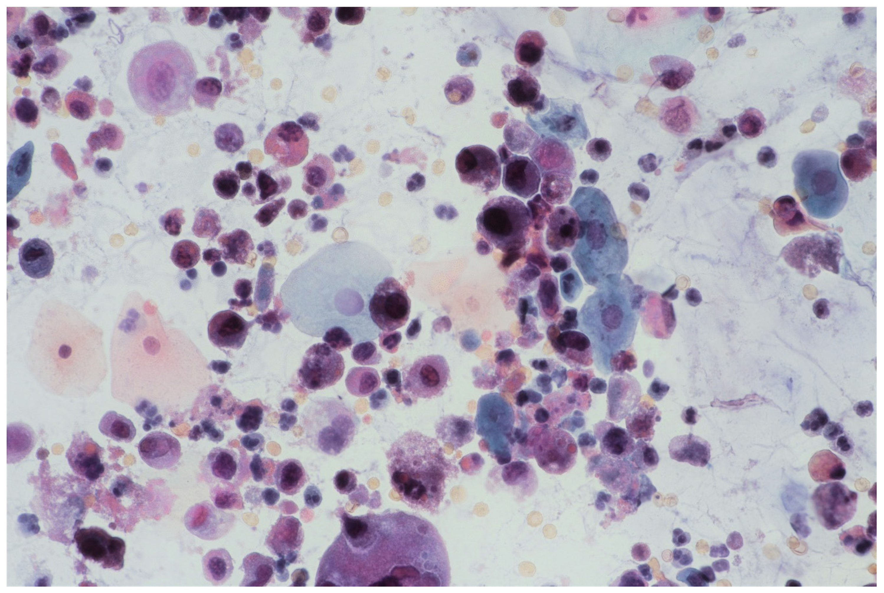 Jpm 11 00362 g001 Jpm 11 00362 g001