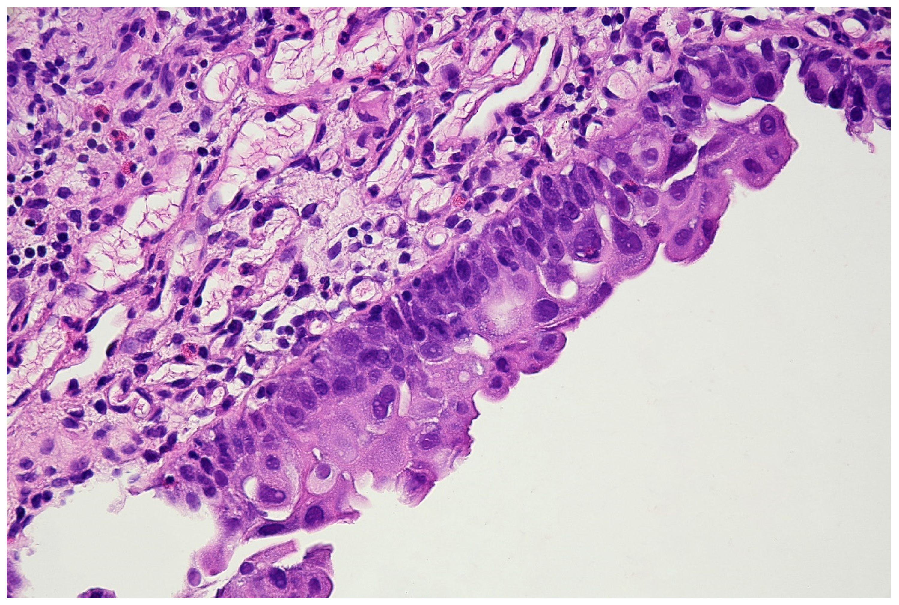 Jpm 11 00362 g006 Jpm 11 00362 g006