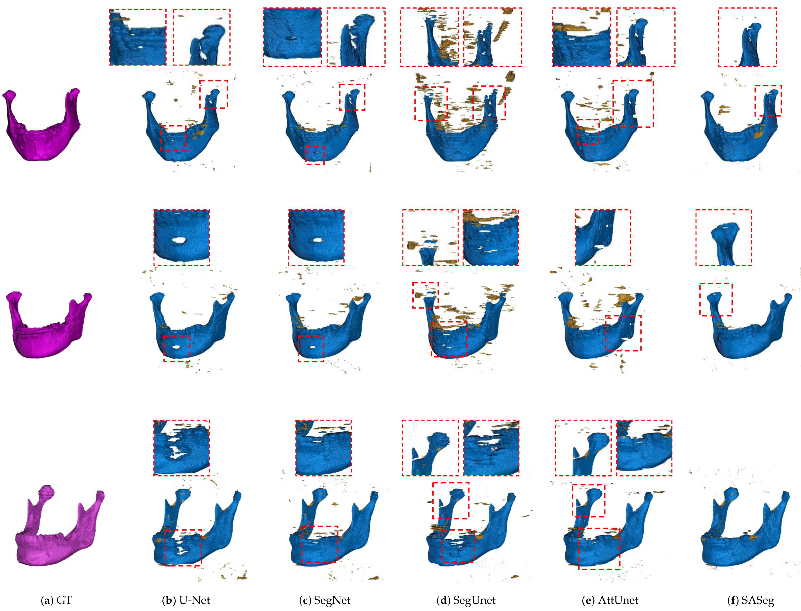 Jpm 11 00364 g006 Jpm 11 00364 g006