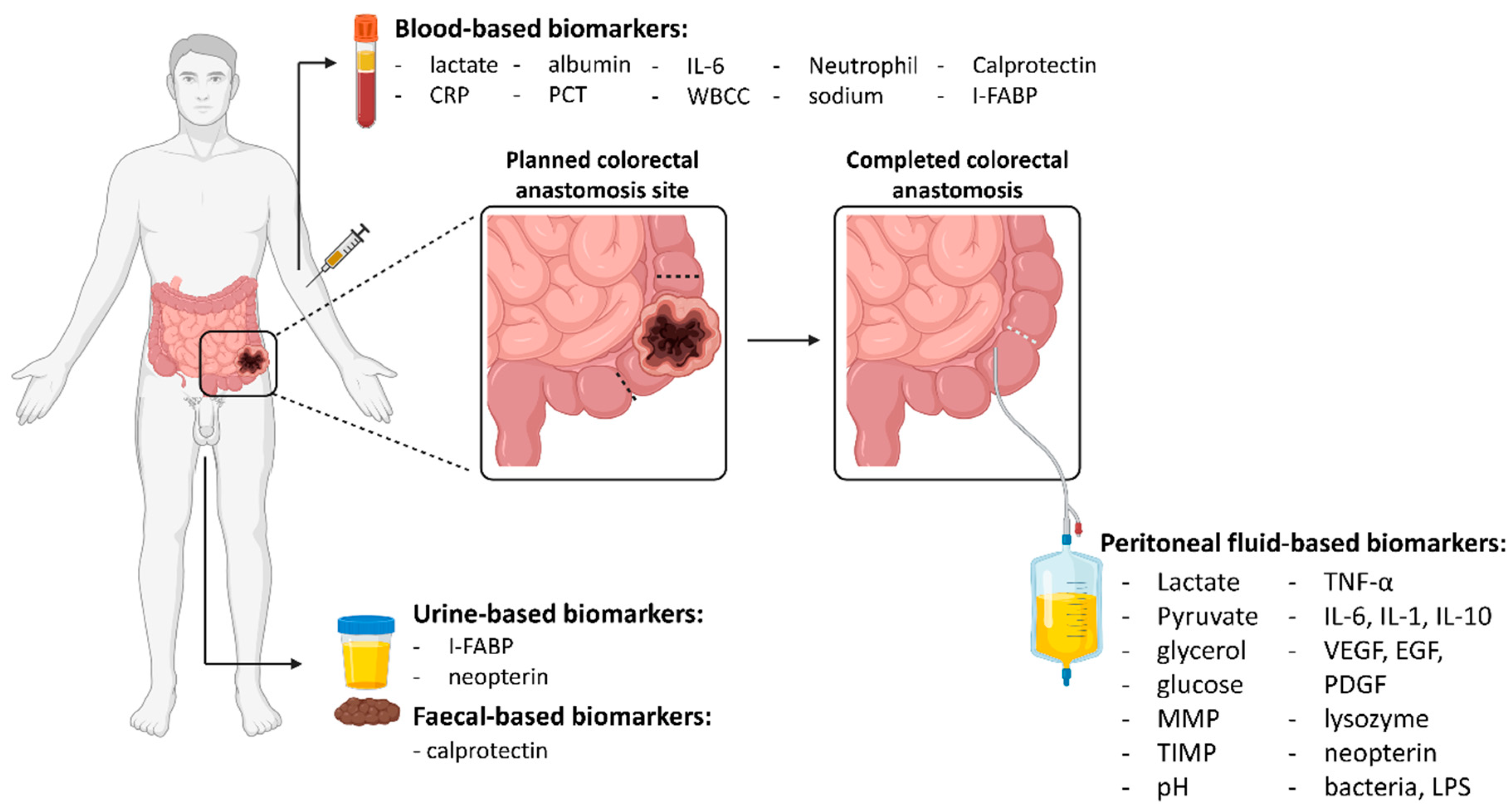 Jpm 11 00471 g001 Jpm 11 00471 g001