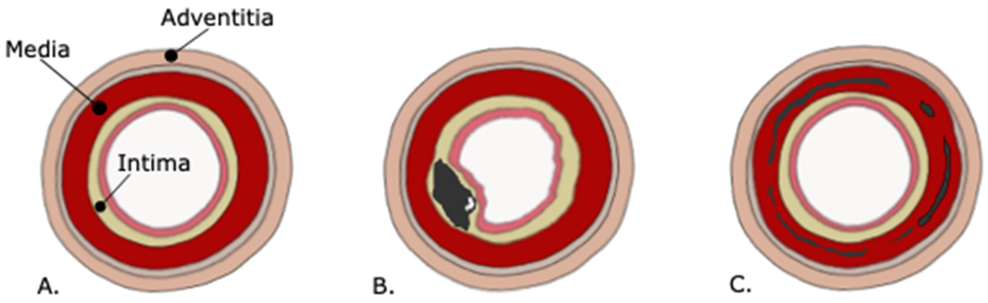 Jpm 11 00493 g001 Jpm 11 00493 g001