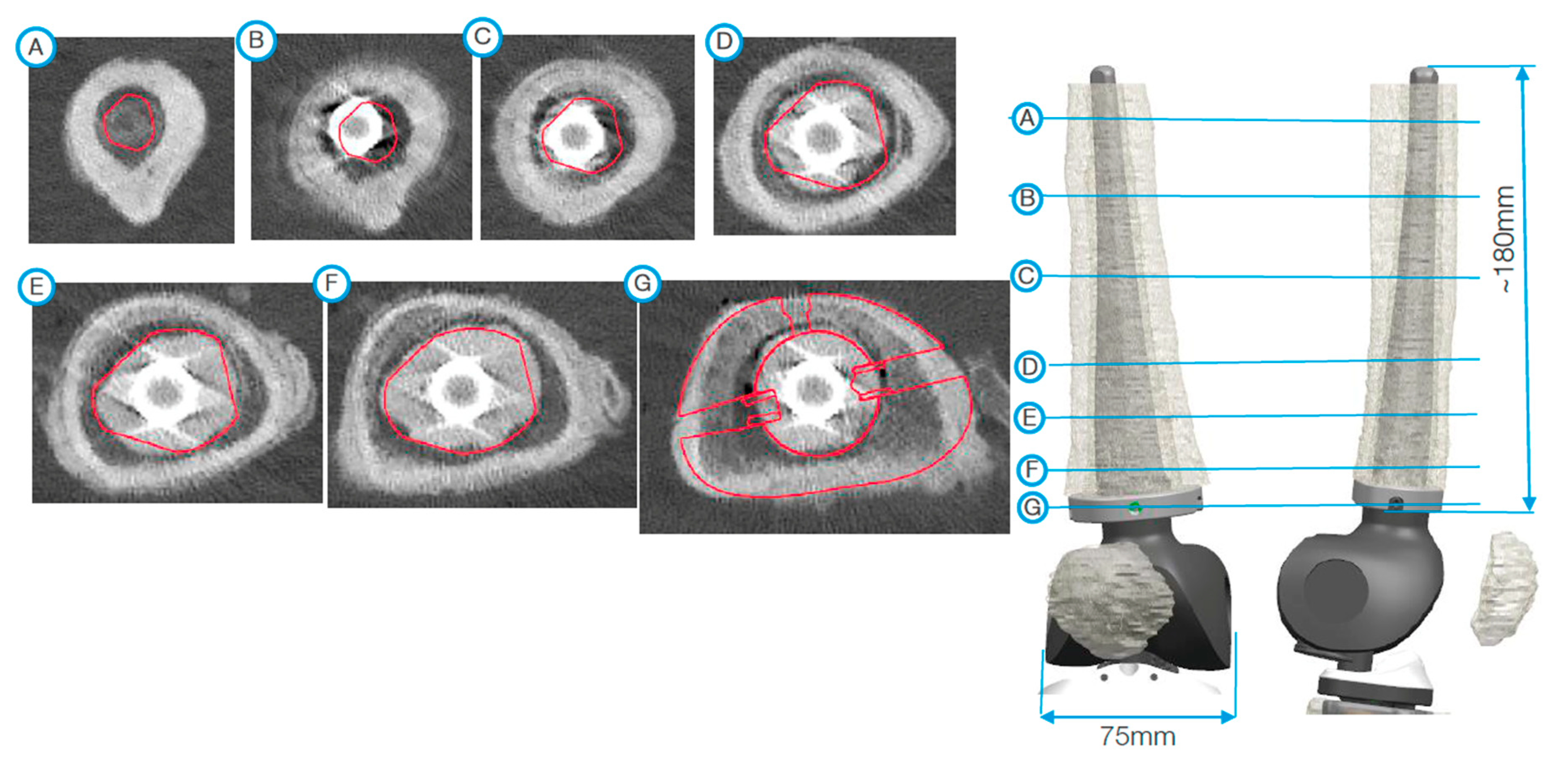 Jpm 11 00572 g003 Jpm 11 00572 g003
