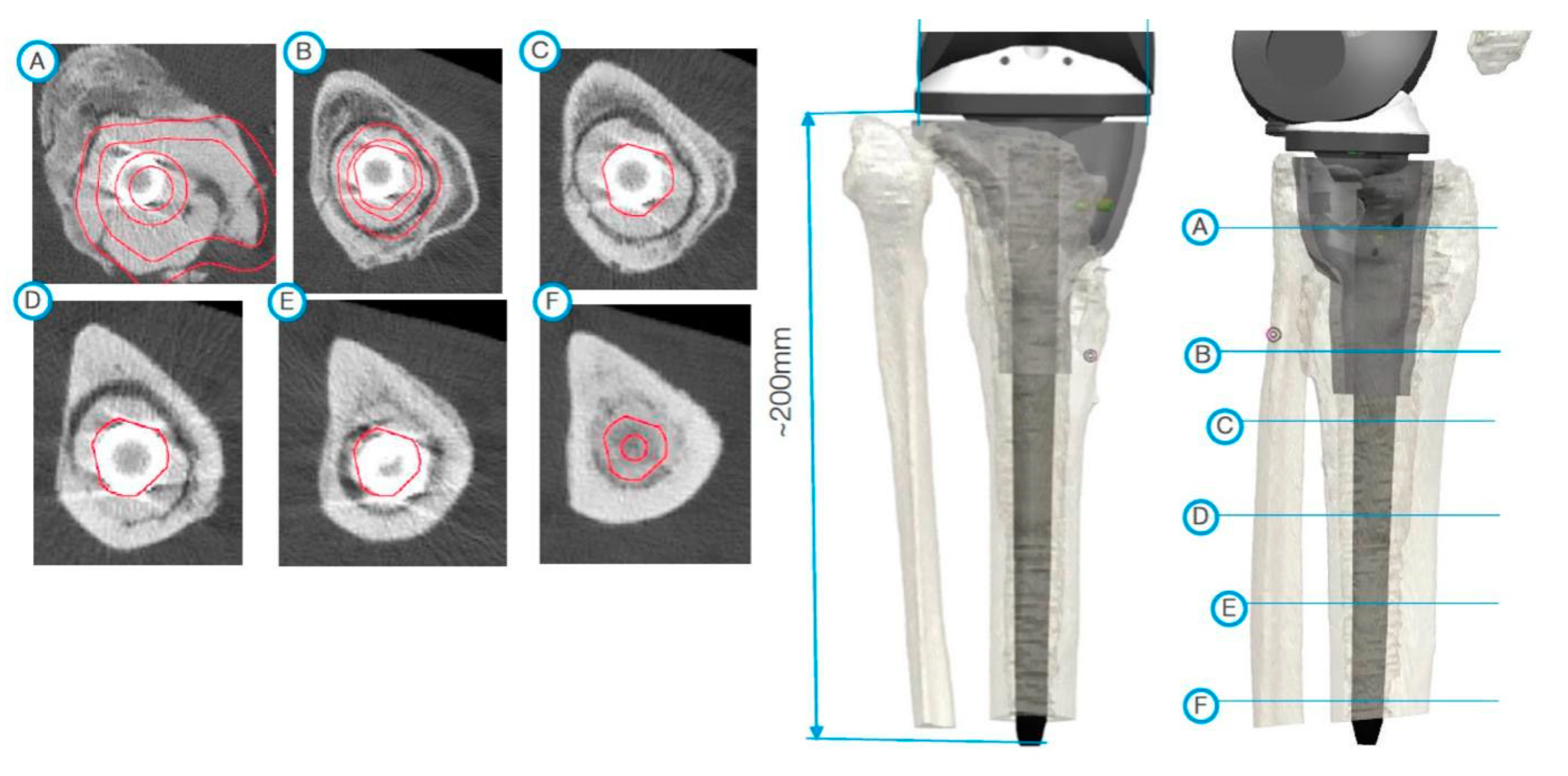 Jpm 11 00572 g004 Jpm 11 00572 g004