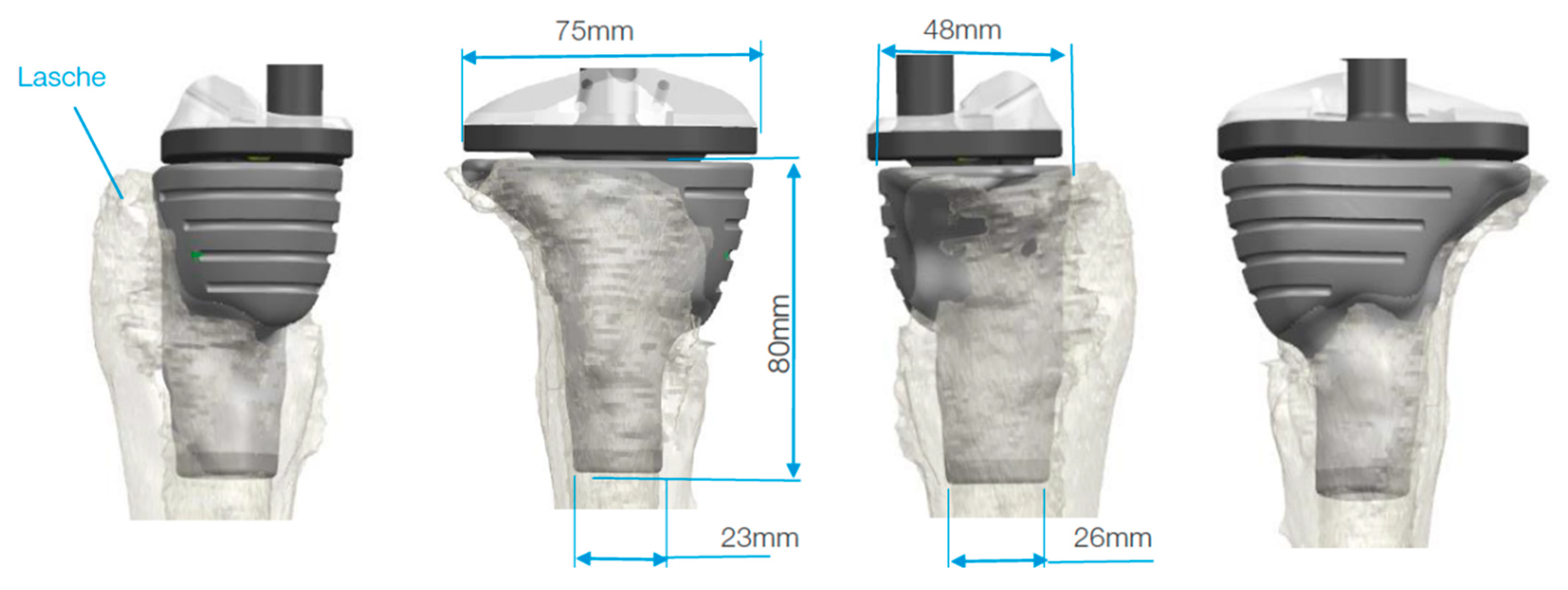 Jpm 11 00572 g005 Jpm 11 00572 g005