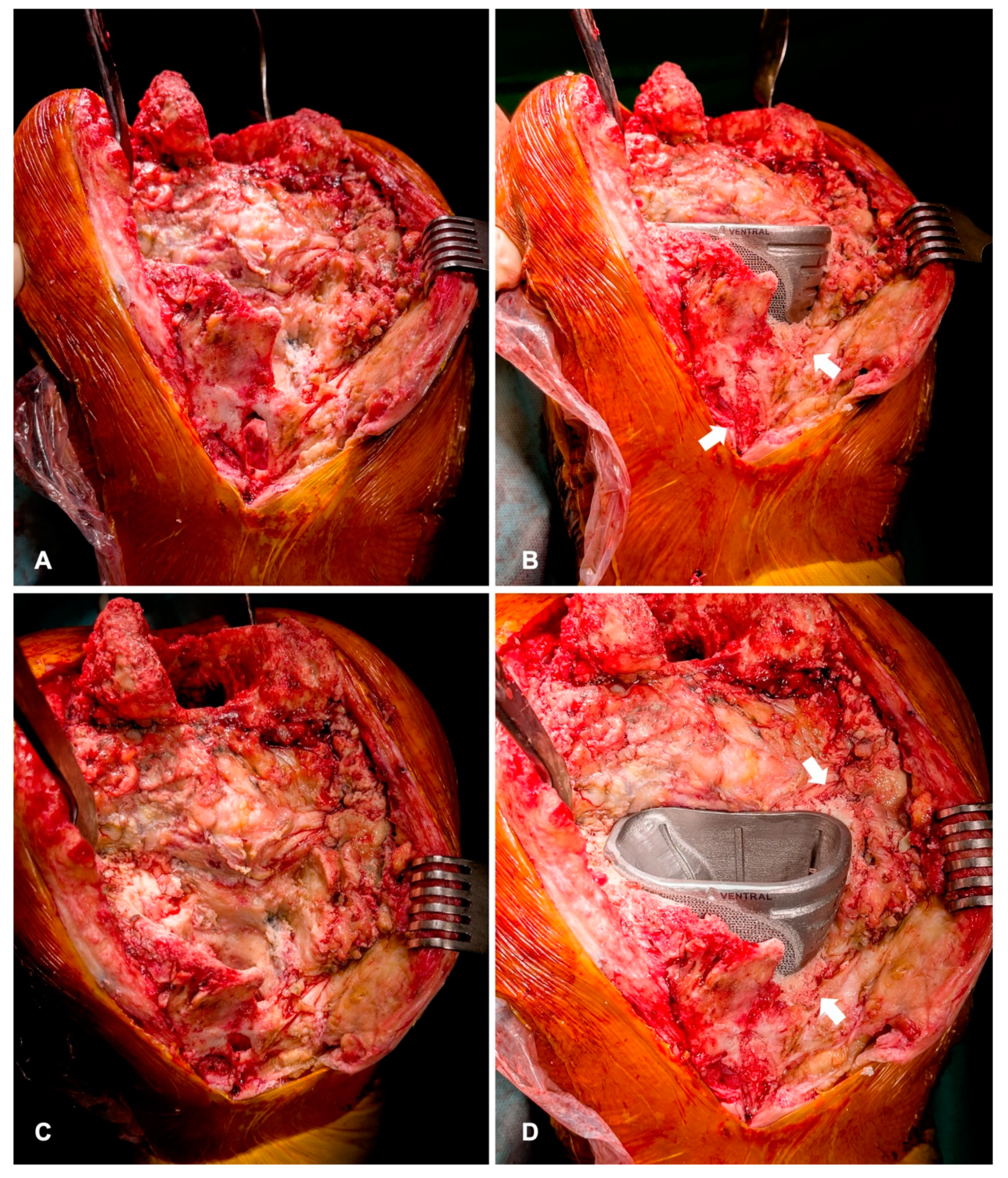 Jpm 11 00572 g007 Jpm 11 00572 g007