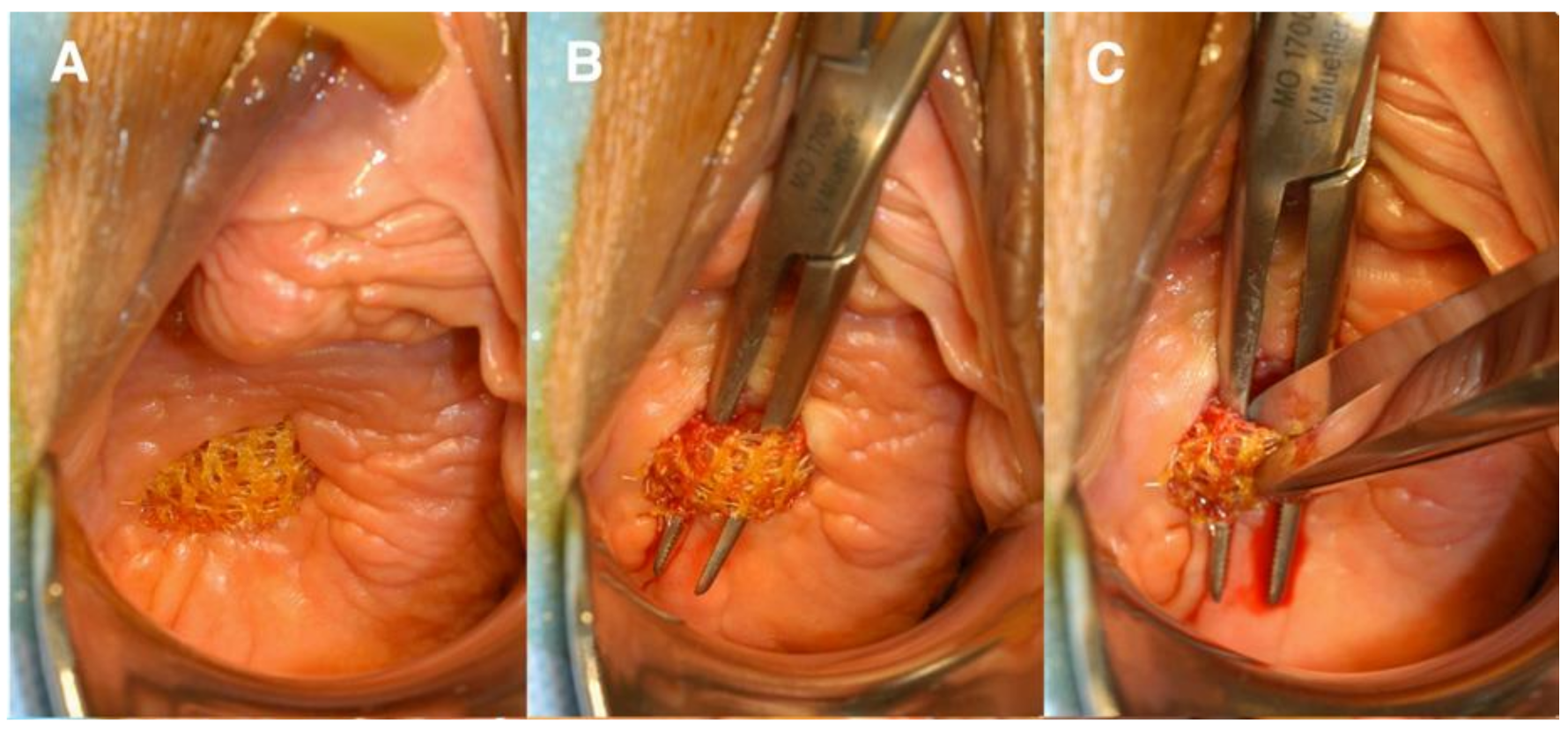 Jpm 11 00840 g004 Jpm 11 00840 g004