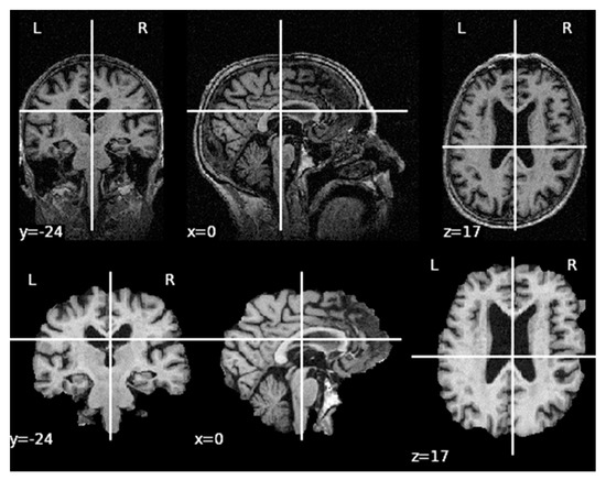 Jpm 11 00902 g0a2 550