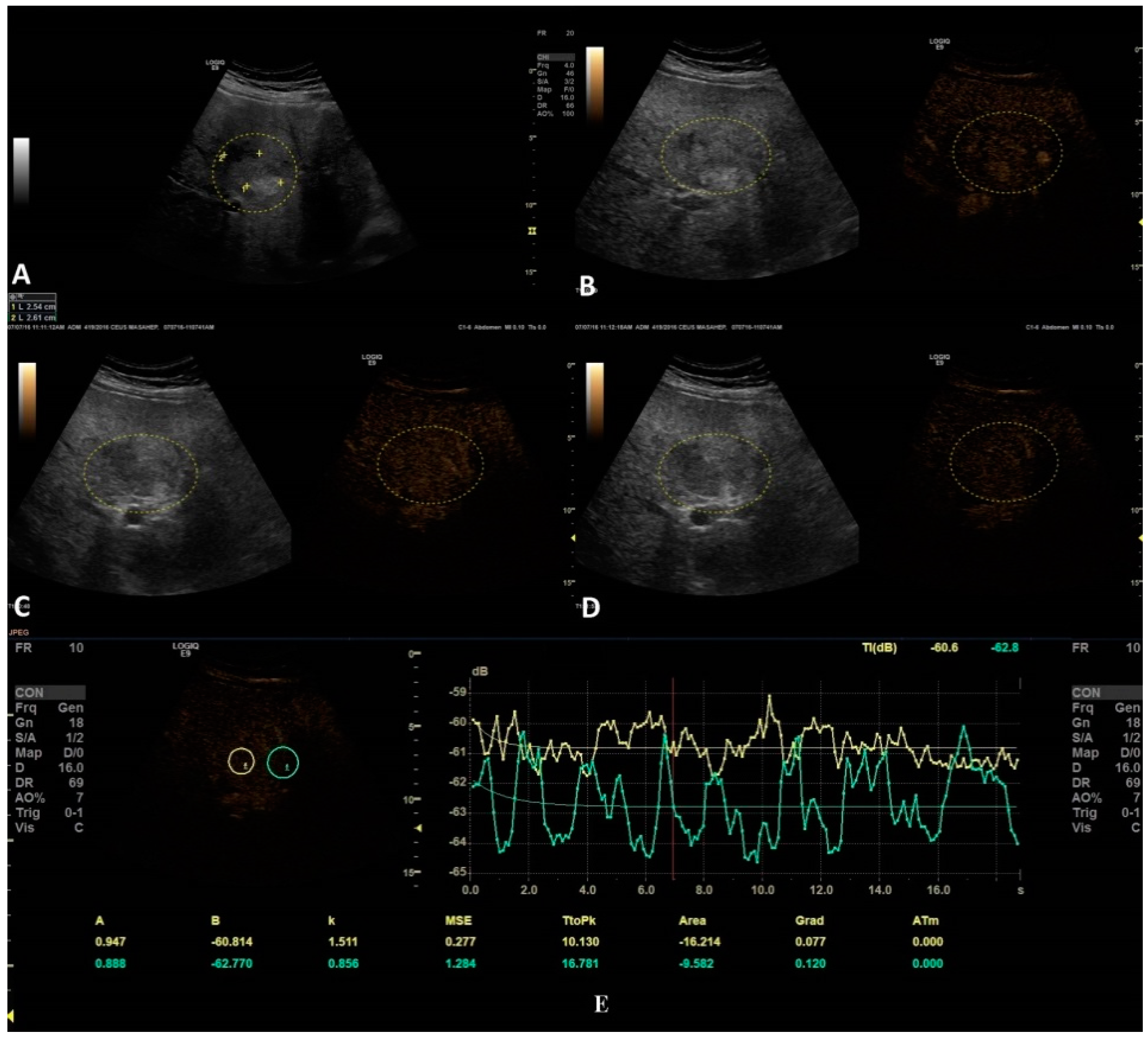 Jpm 11 01388 g004 Jpm 11 01388 g004