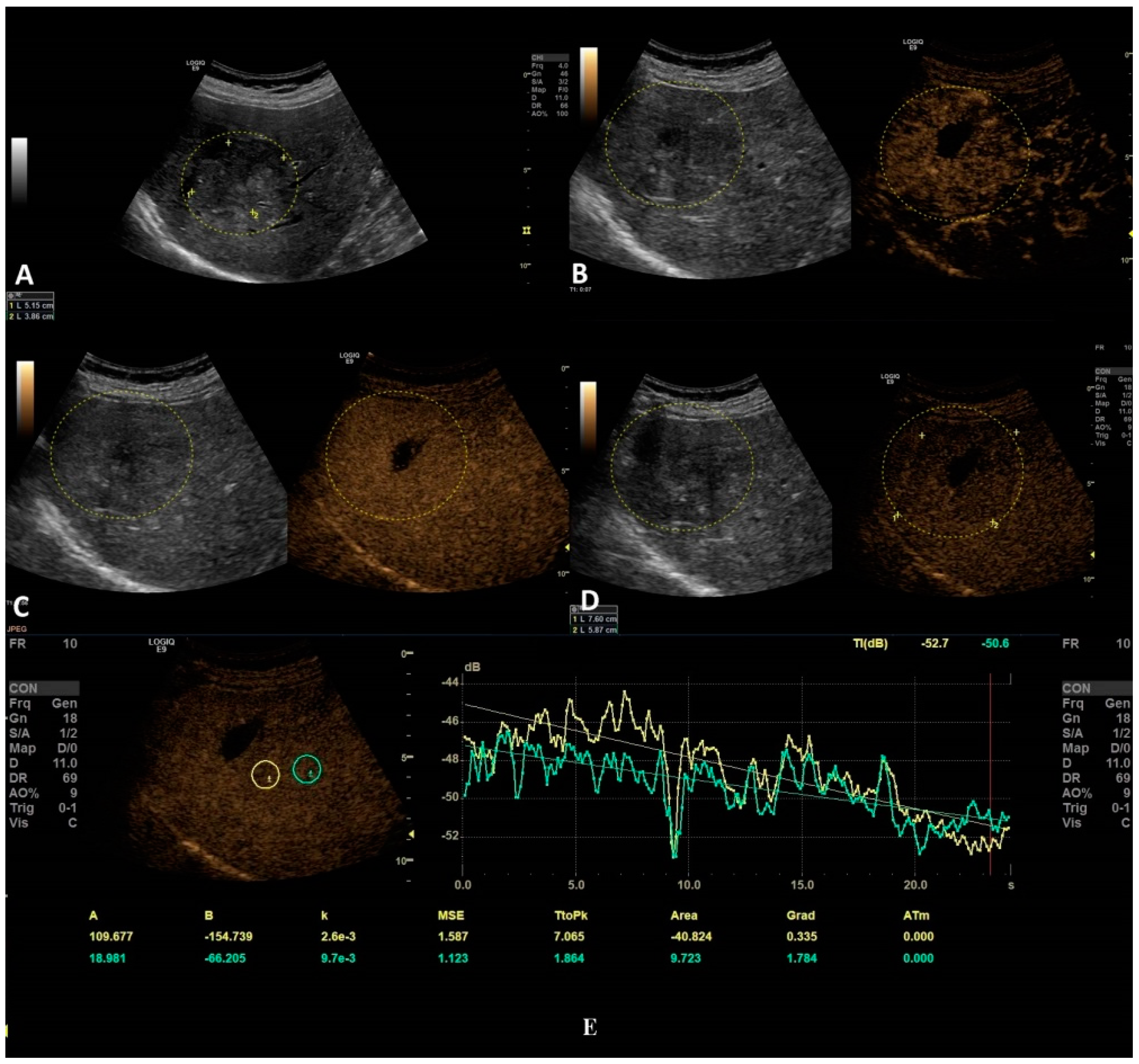 Jpm 11 01388 g005 Jpm 11 01388 g005