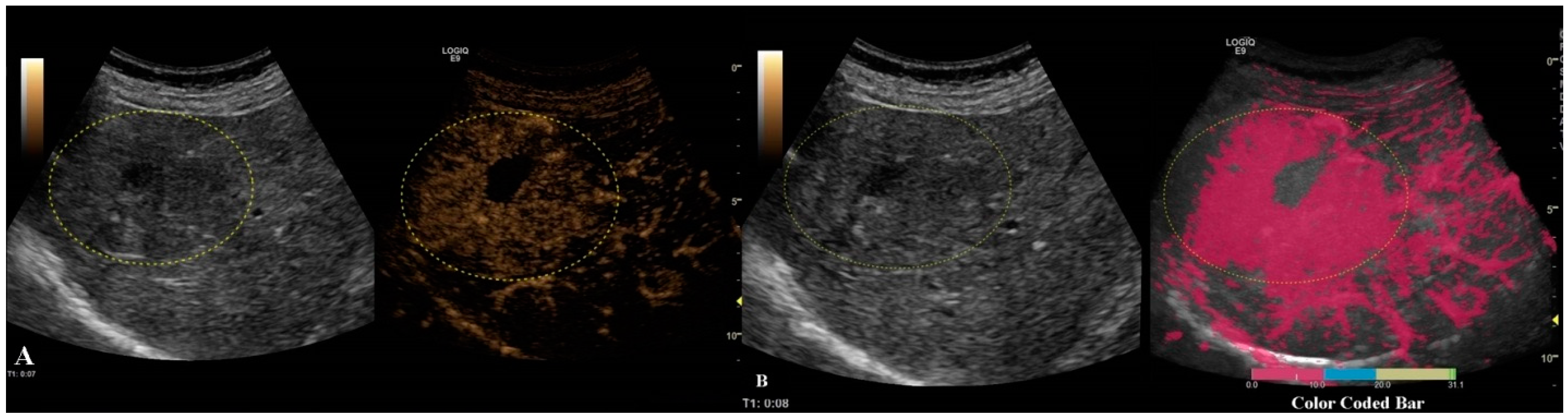 Jpm 11 01388 g006 Jpm 11 01388 g006