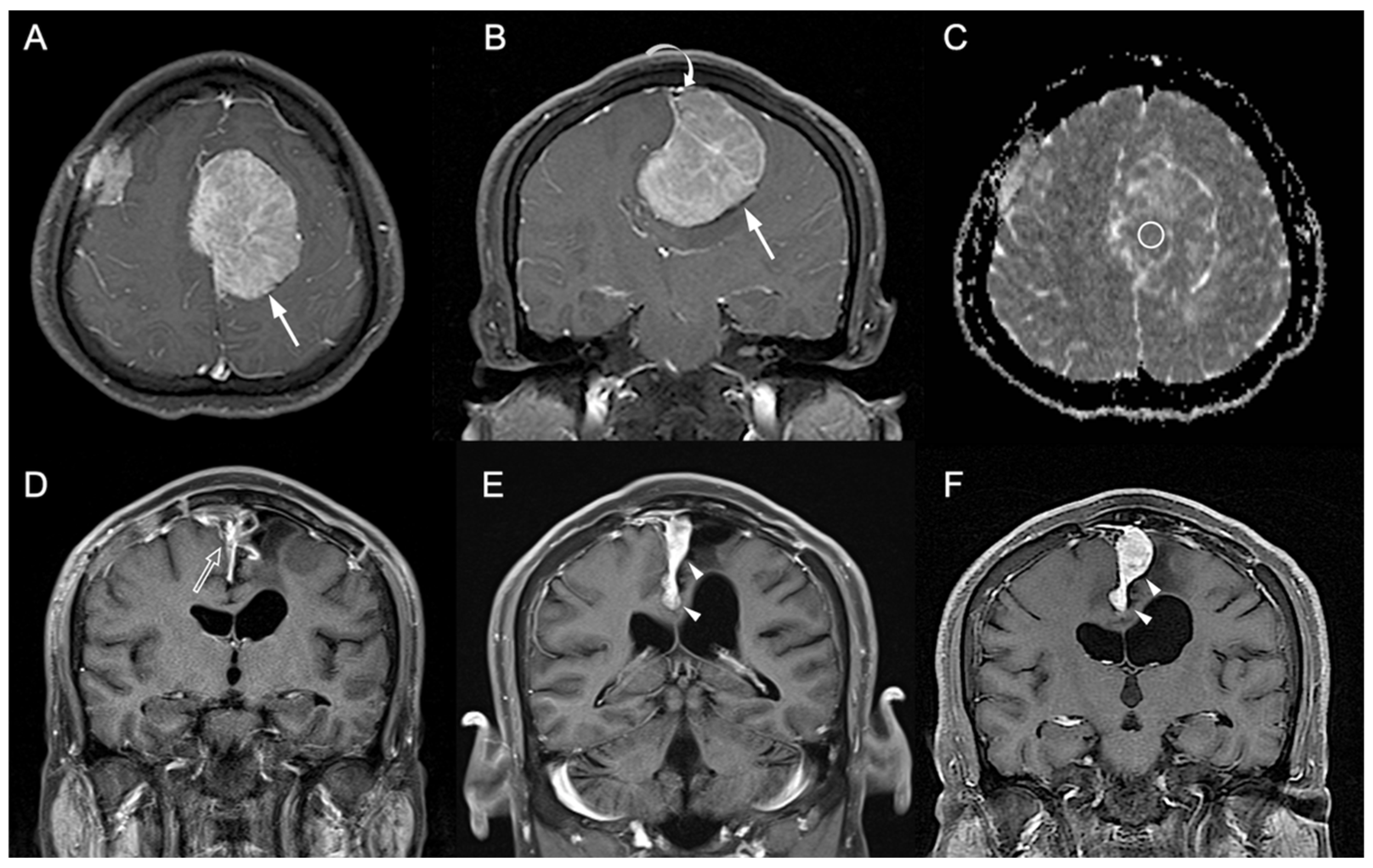Jpm 12 00522 g002 Jpm 12 00522 g002